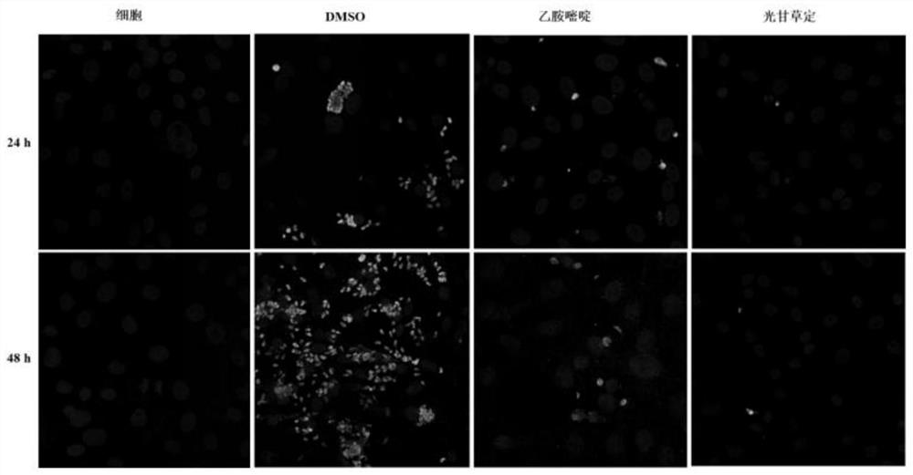 Method for treating toxoplasmosis by using isoflavanoid compound glabridin