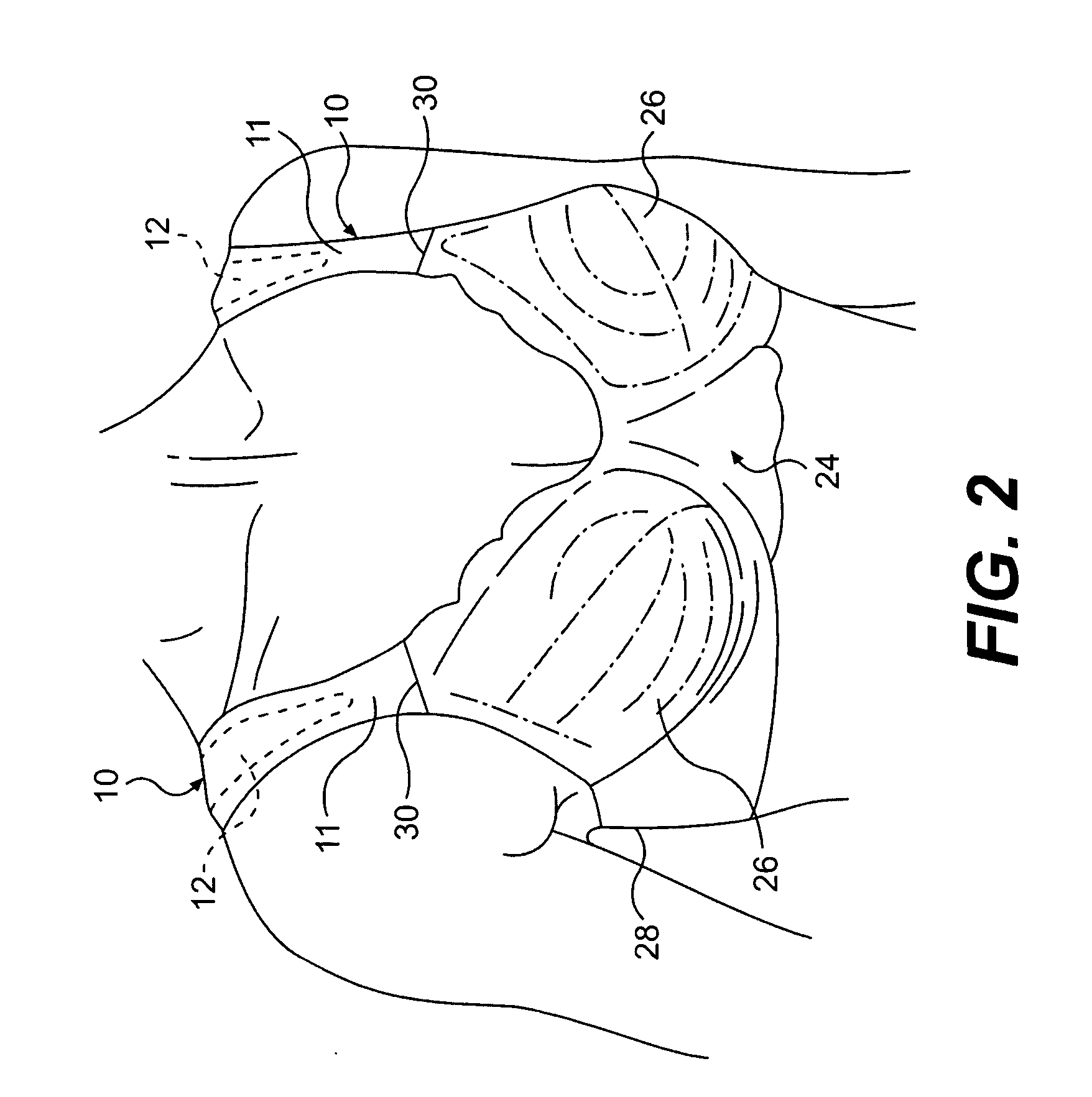 Cushioning laminate insert for a garment shoulder strap, and method for making the same