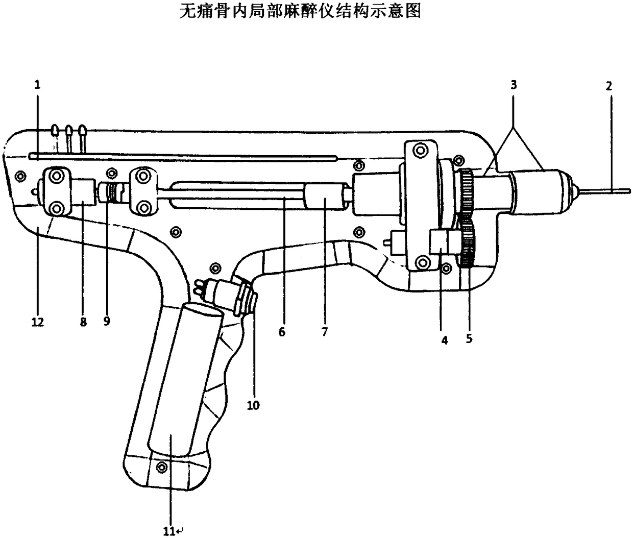 Painless intraosseous local anesthesia injector