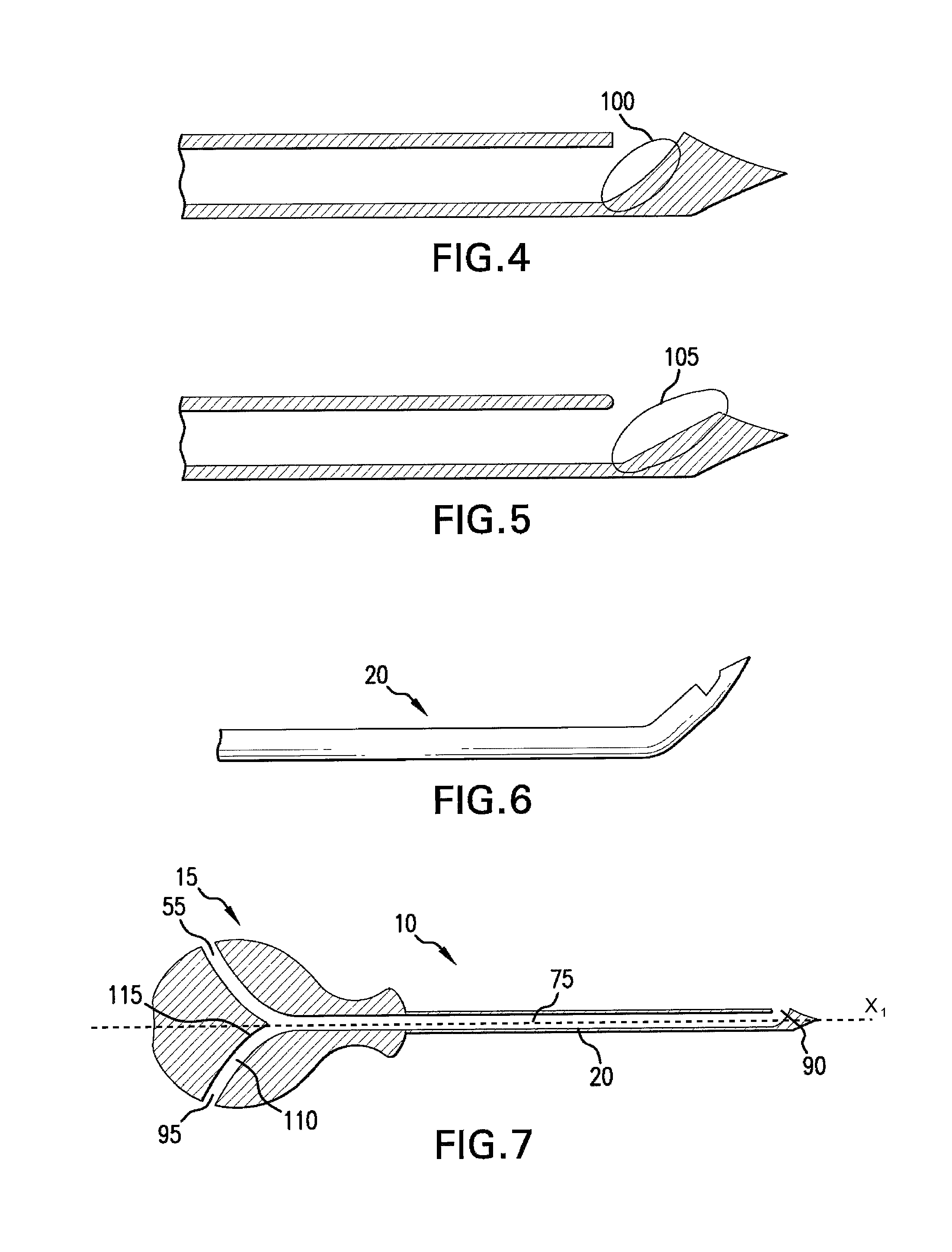 Cannula with lateral access and directional exit port