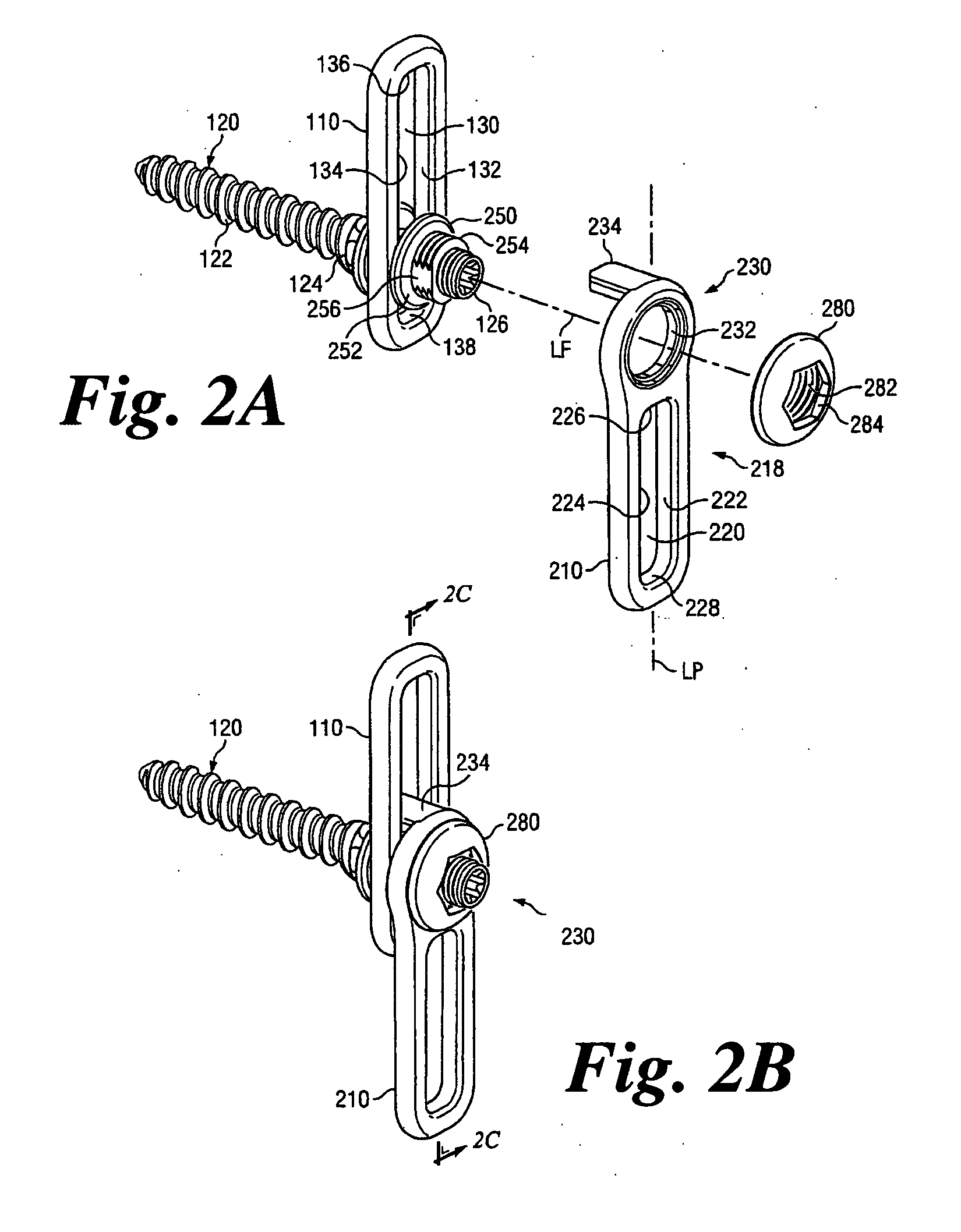 Revision Fixation Plate and Method of Use