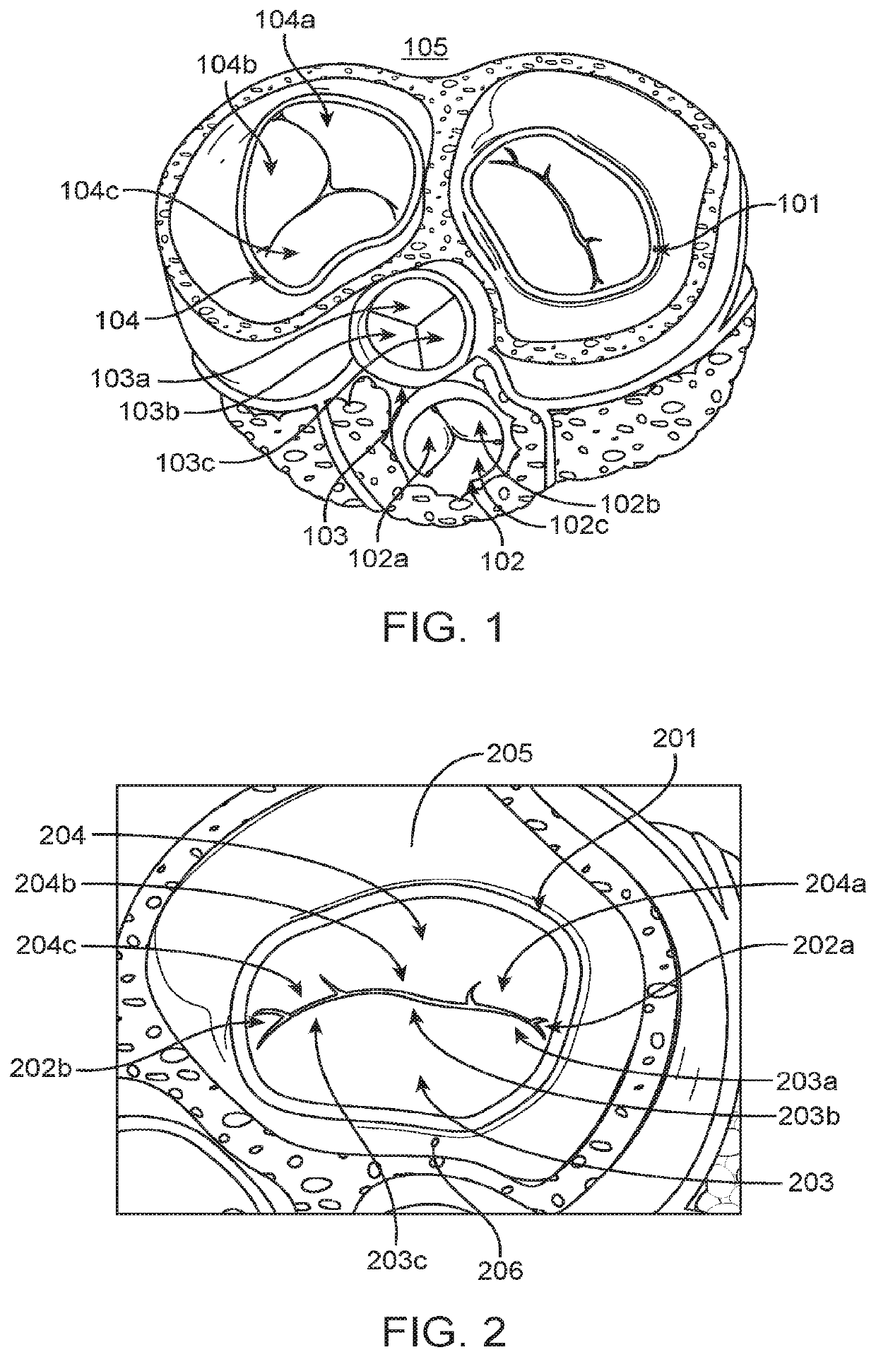 Methods and devices for heart valve repair