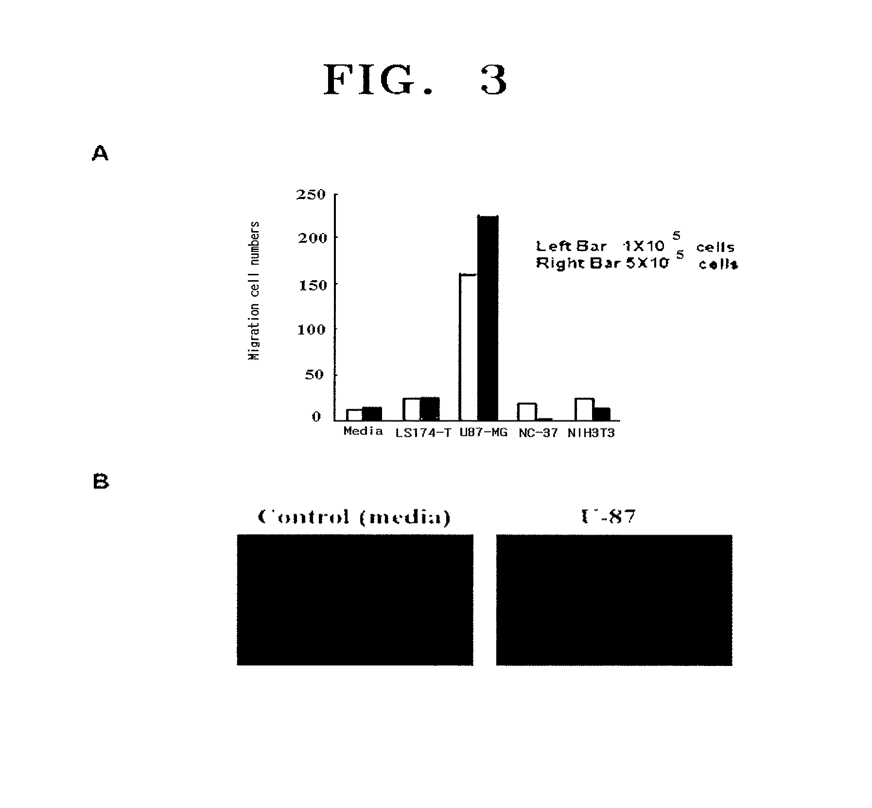 UCB-MSCs comprising a tumor suppressor gene reduce the size of an IL-8 or GRO-alphaexpressing tumor