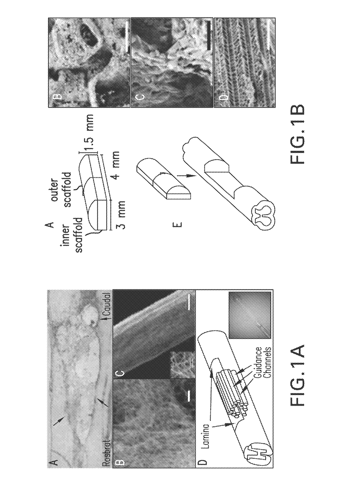 Magnetic directed alignment of stem cell scaffolds for regeneration