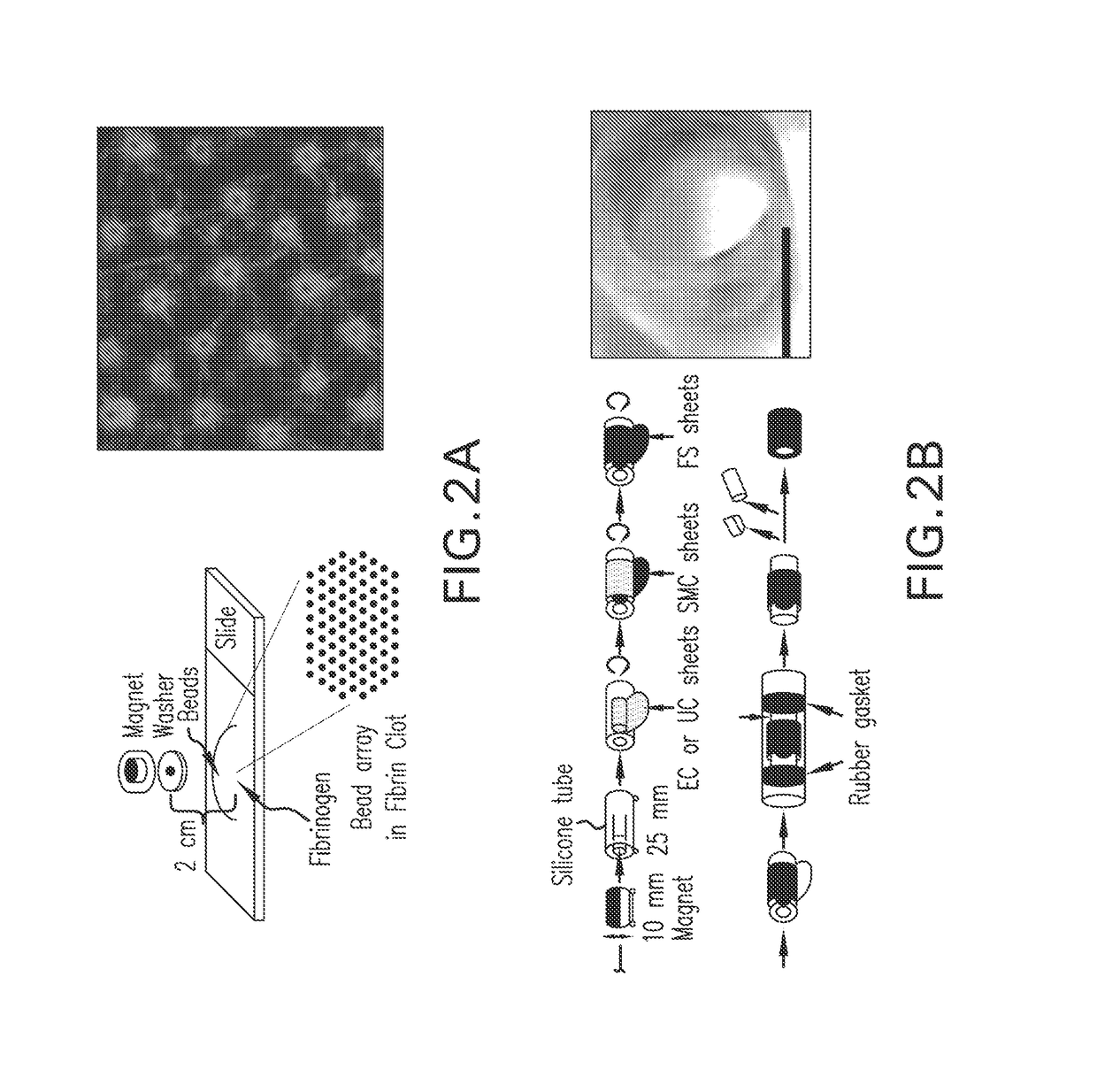 Magnetic directed alignment of stem cell scaffolds for regeneration