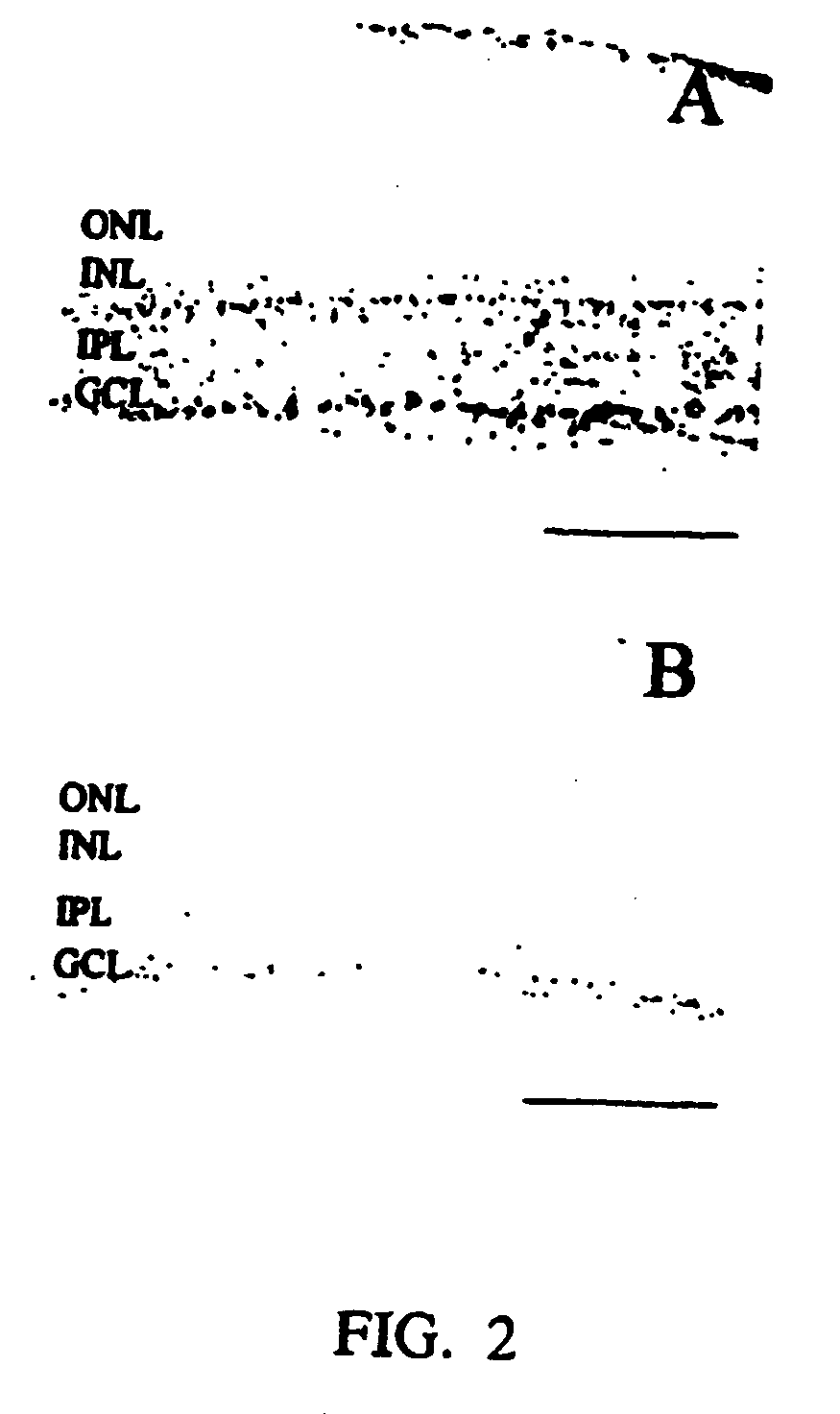 Neuroprotectant methods, compositions, and screening methods thereof