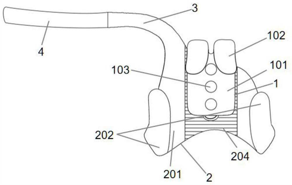 A kind of elastic internal fixation device of sternoclavicular joint