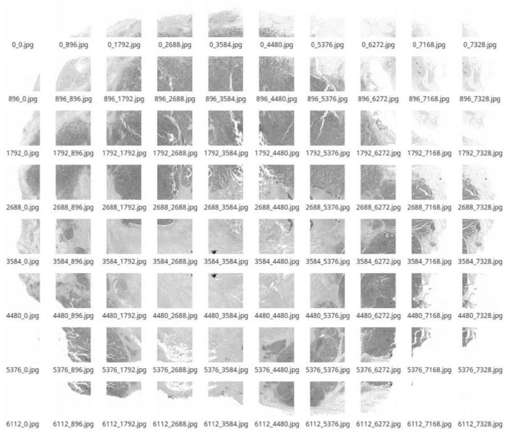 A deep learning-based segmentation method for breast cancer pathological images he cancer nest