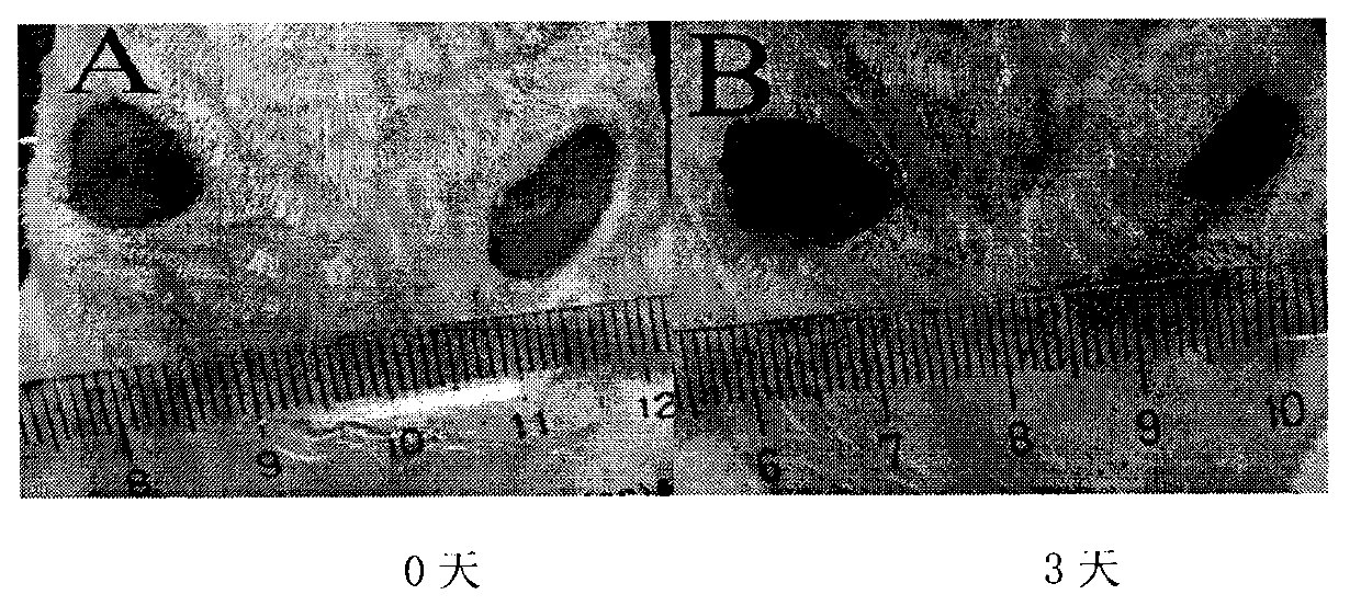 Starch-hyaluronic acid hemostatic agent and preparation method thereof