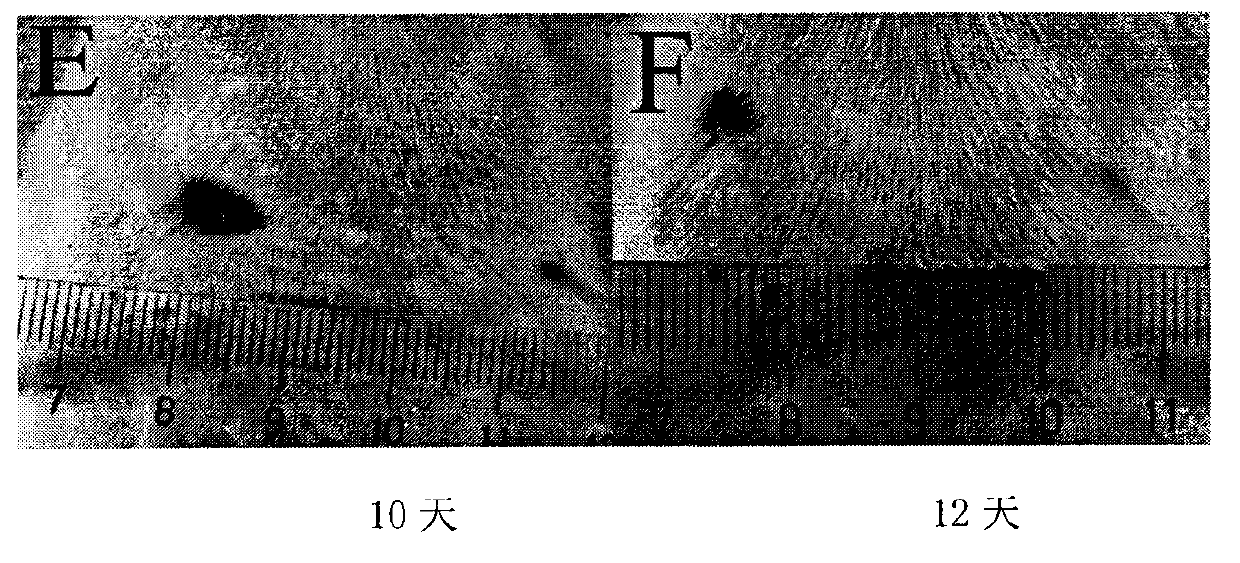 Starch-hyaluronic acid hemostatic agent and preparation method thereof