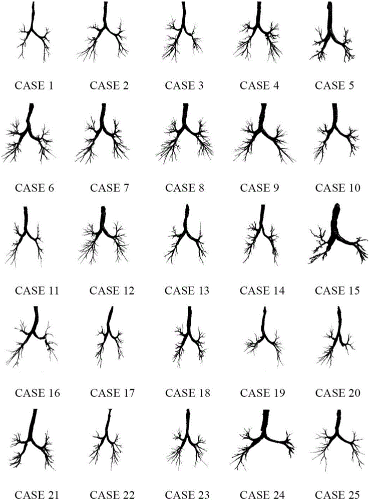 Two-pass region growing and morphological reconstruction combination-based lung airway tree segmentation method