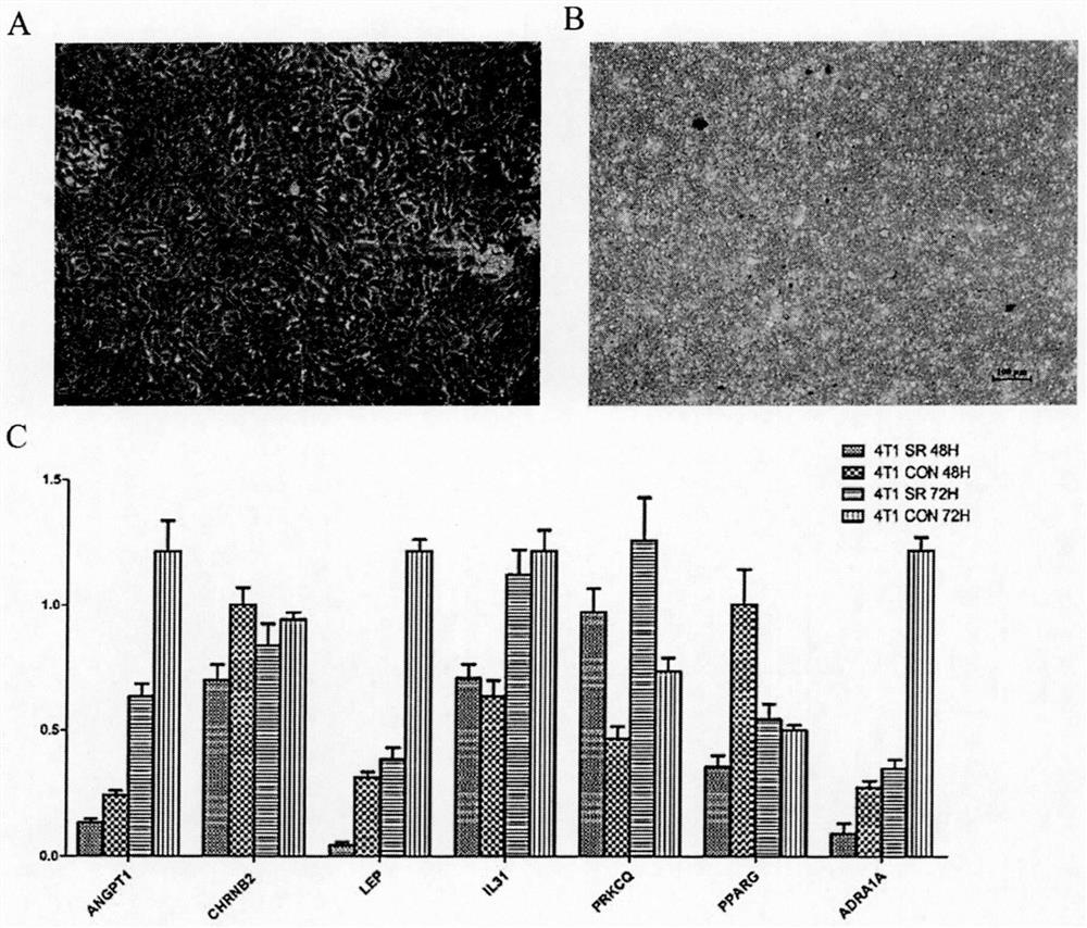 A combination drug combination for immunotherapy of breast cancer and its application