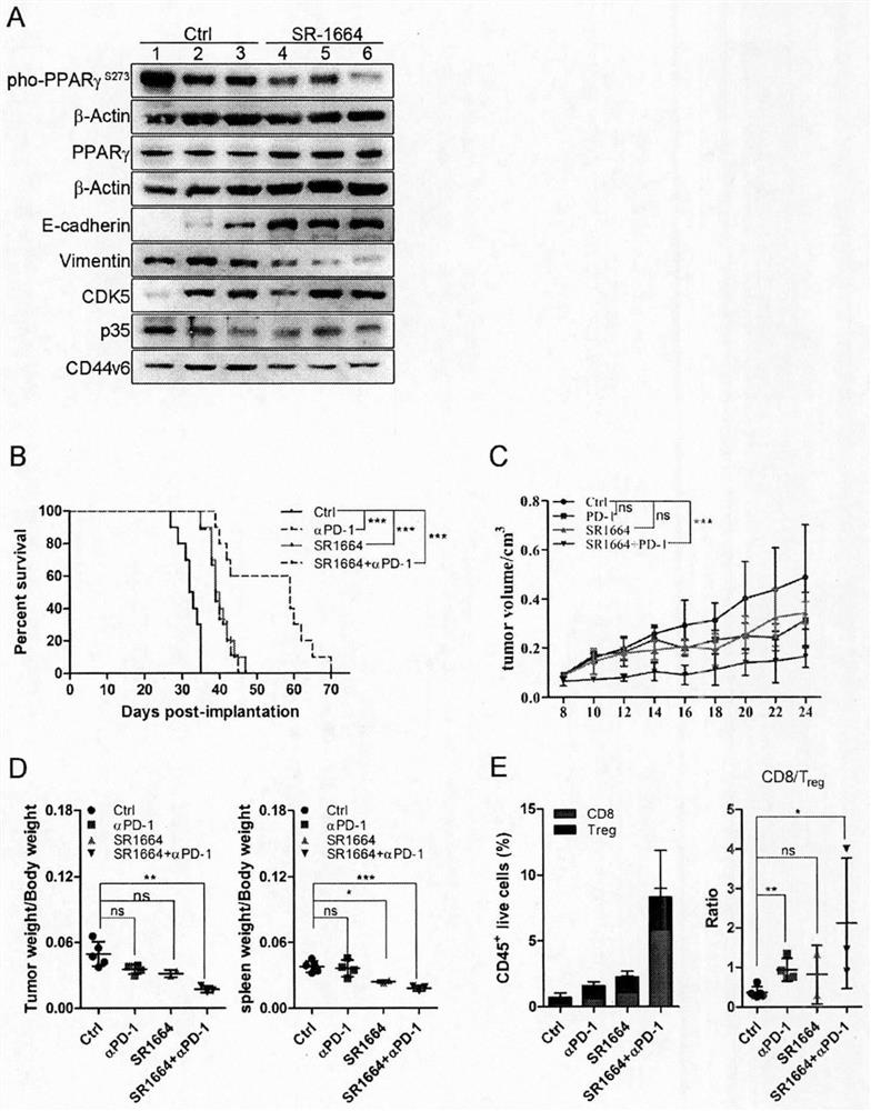 A combination drug combination for immunotherapy of breast cancer and its application