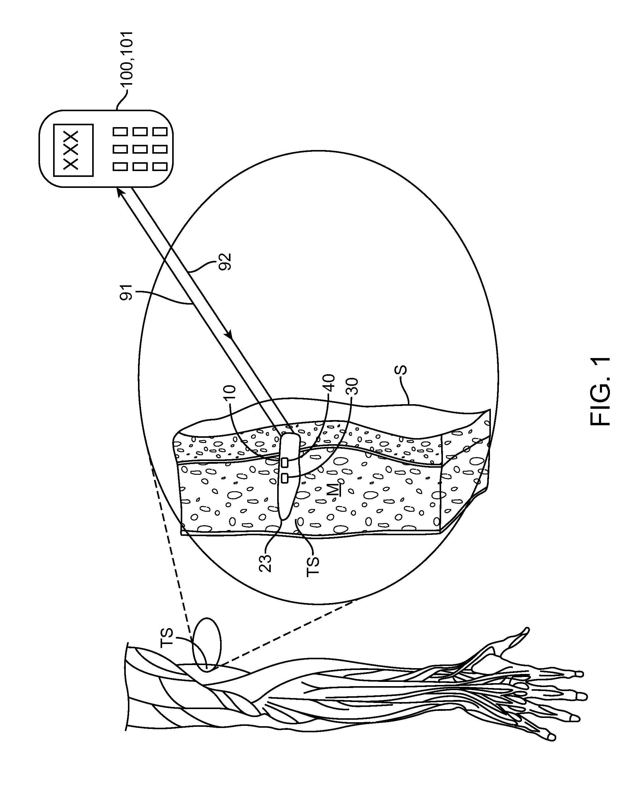 Implantable oximetric measurement apparatus and method of use
