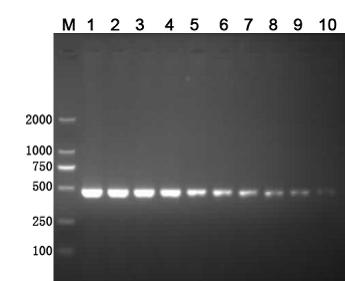 EMA-PCR (Ethidium Monoazide-Polymerase Chain Reaction) detection method of viable pathogen in farm environment