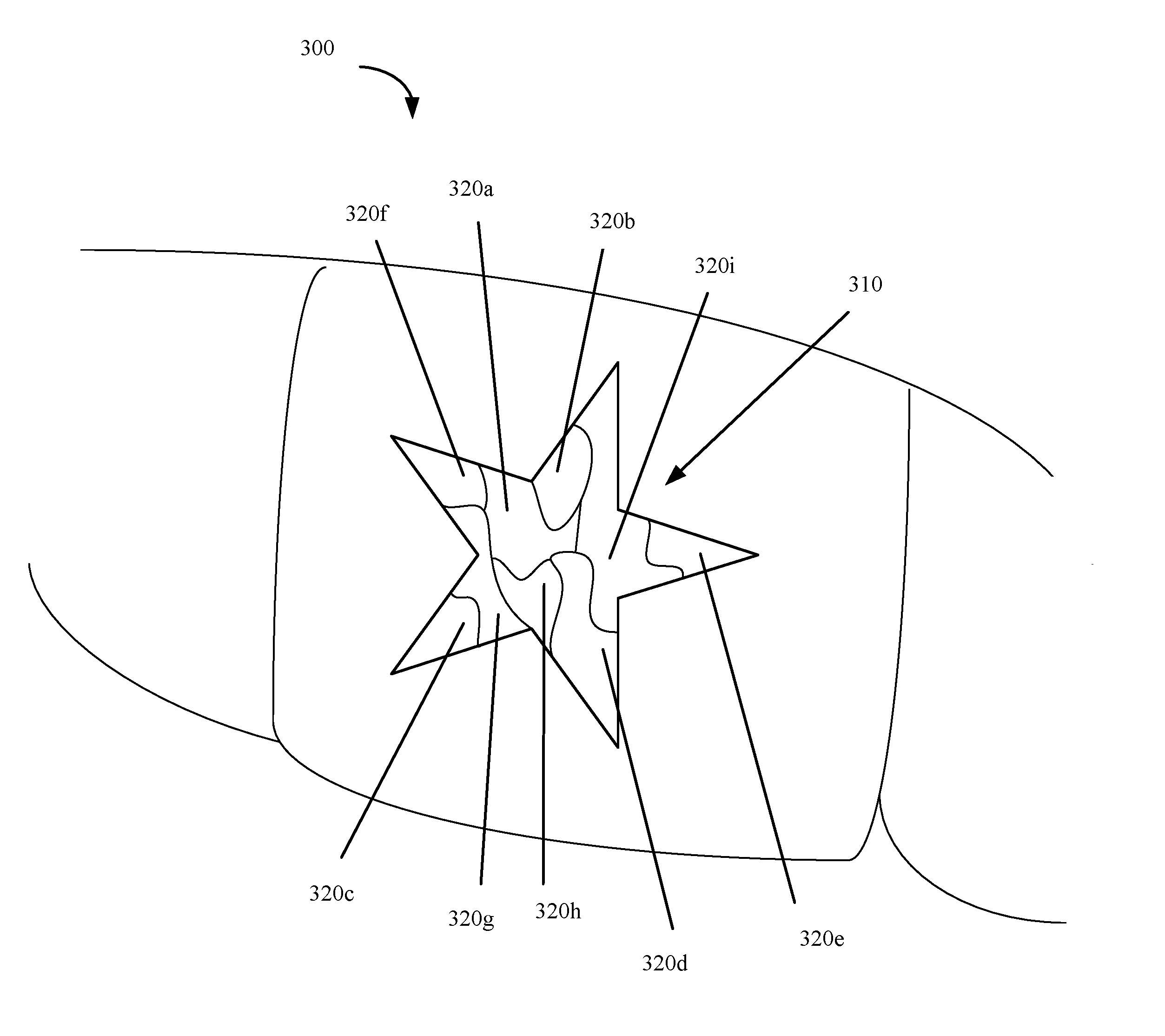 Systems, apparatuses and methods for substance delivery from dental appliance