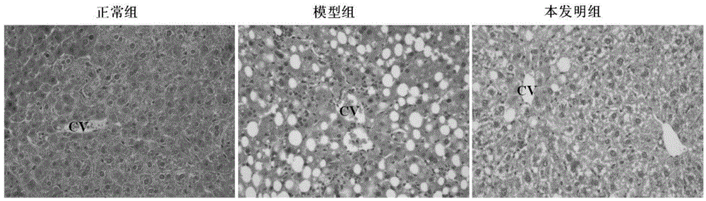 Non-alcoholic fatty liver disease prevention and control compound preparation and use thereof