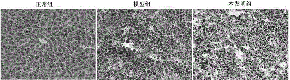 Non-alcoholic fatty liver disease prevention and control compound preparation and use thereof