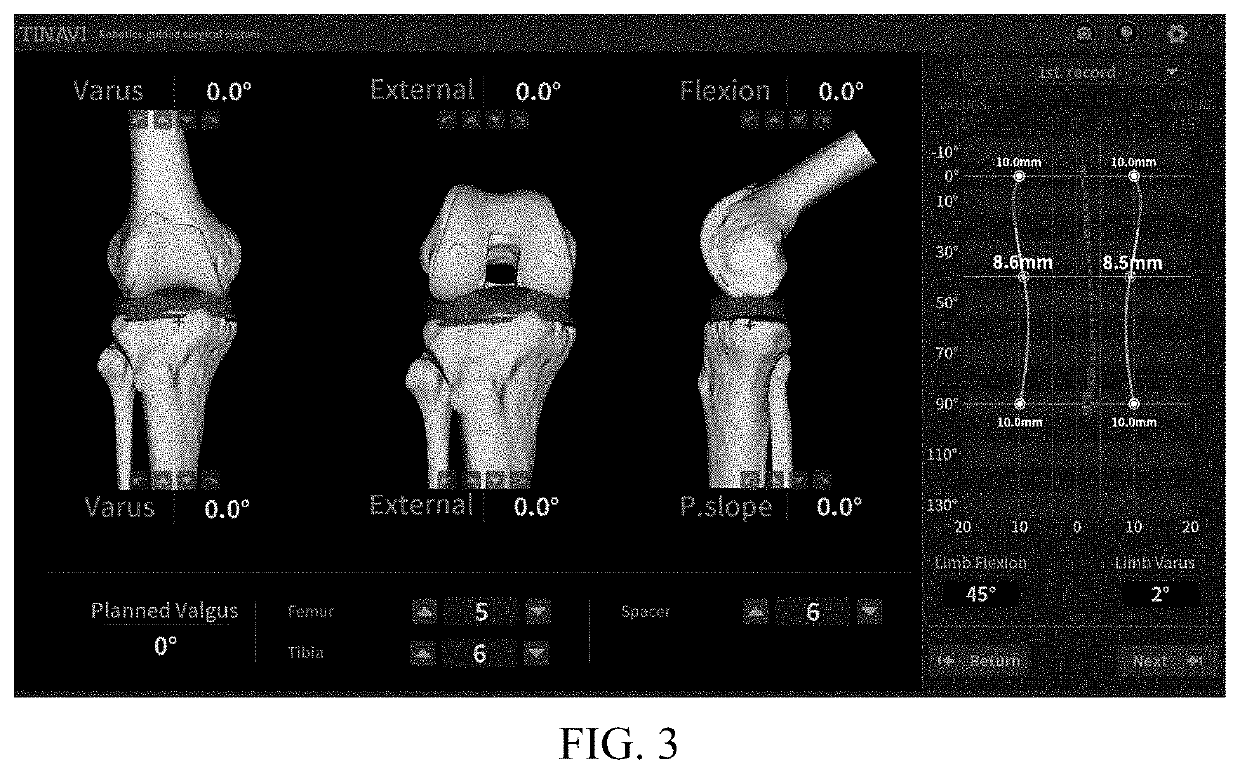 Total knee arthroplasty robot auxiliary system, control method and electronic device