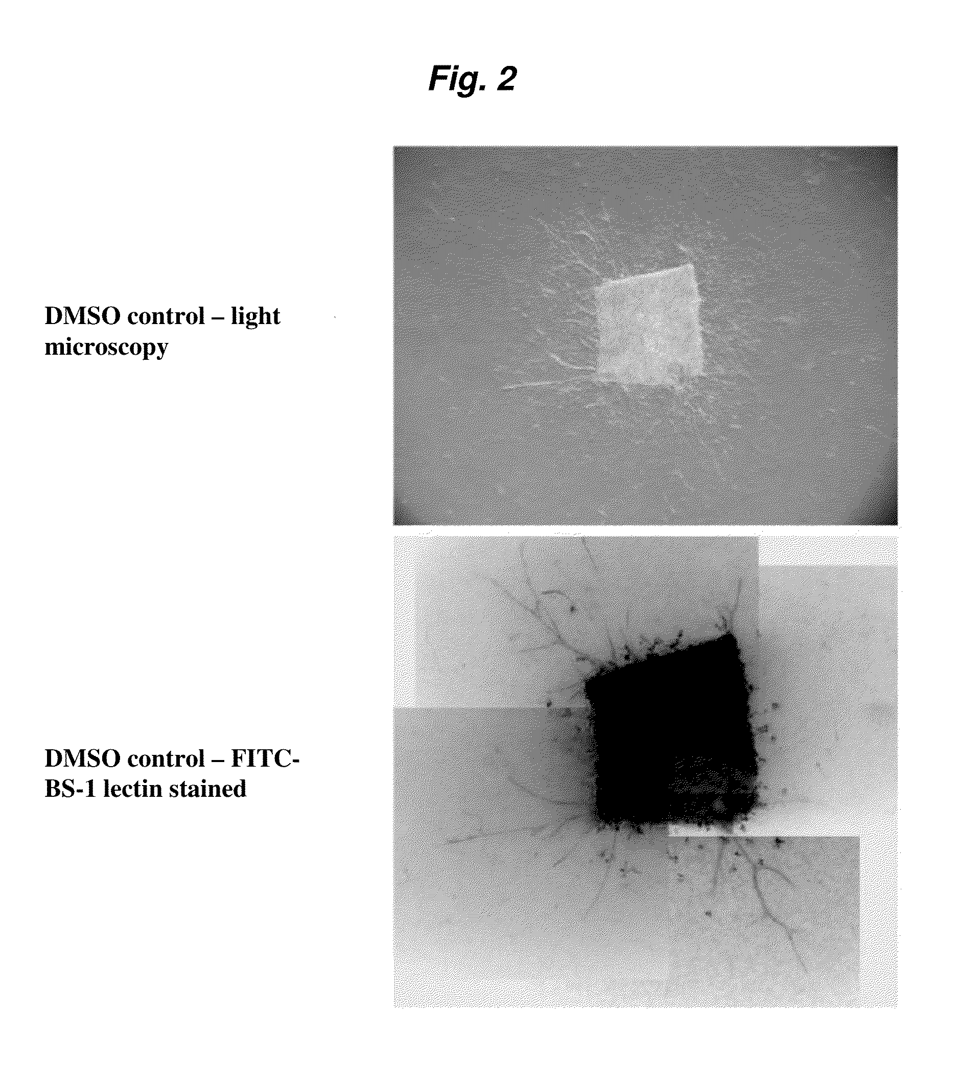 Methods and compositions for inhibiting angiogenesis