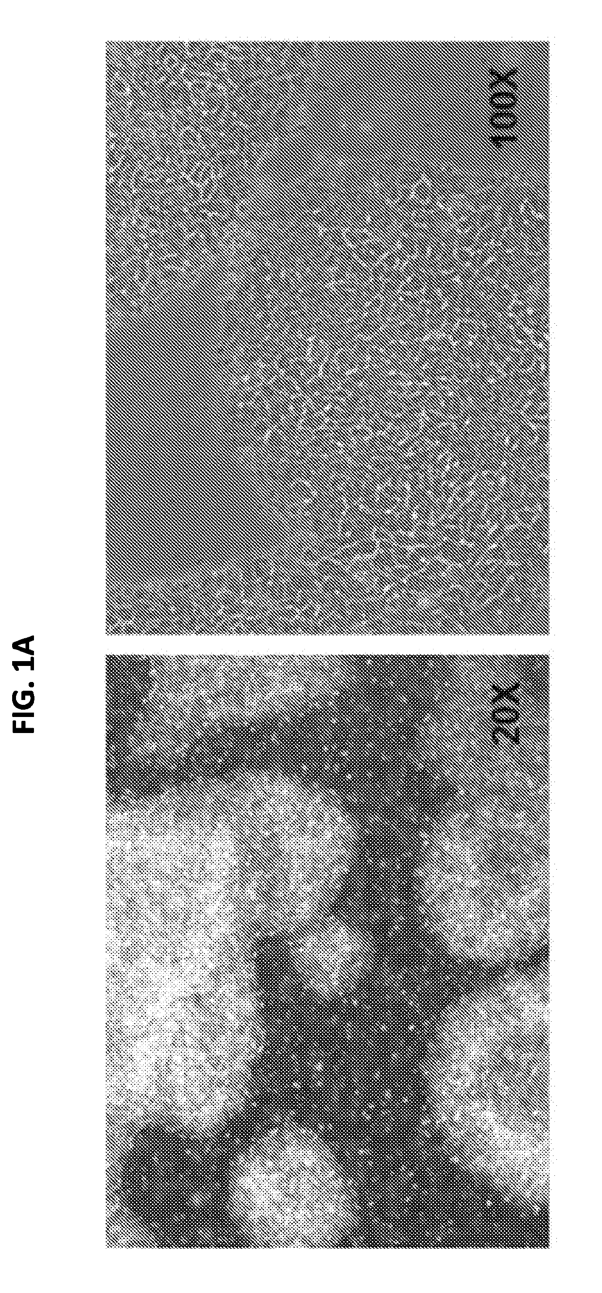 Method for reproducible differentiation of clinical-grade retinal pigment epithelium cells