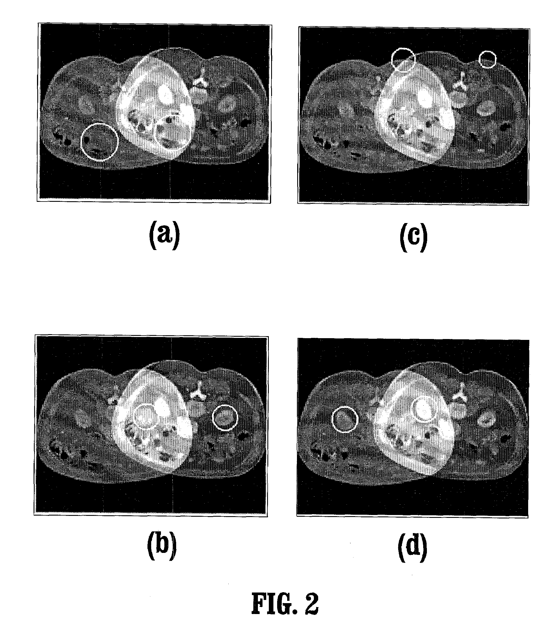 System and method for salient region feature based 3D multi modality registration of medical images
