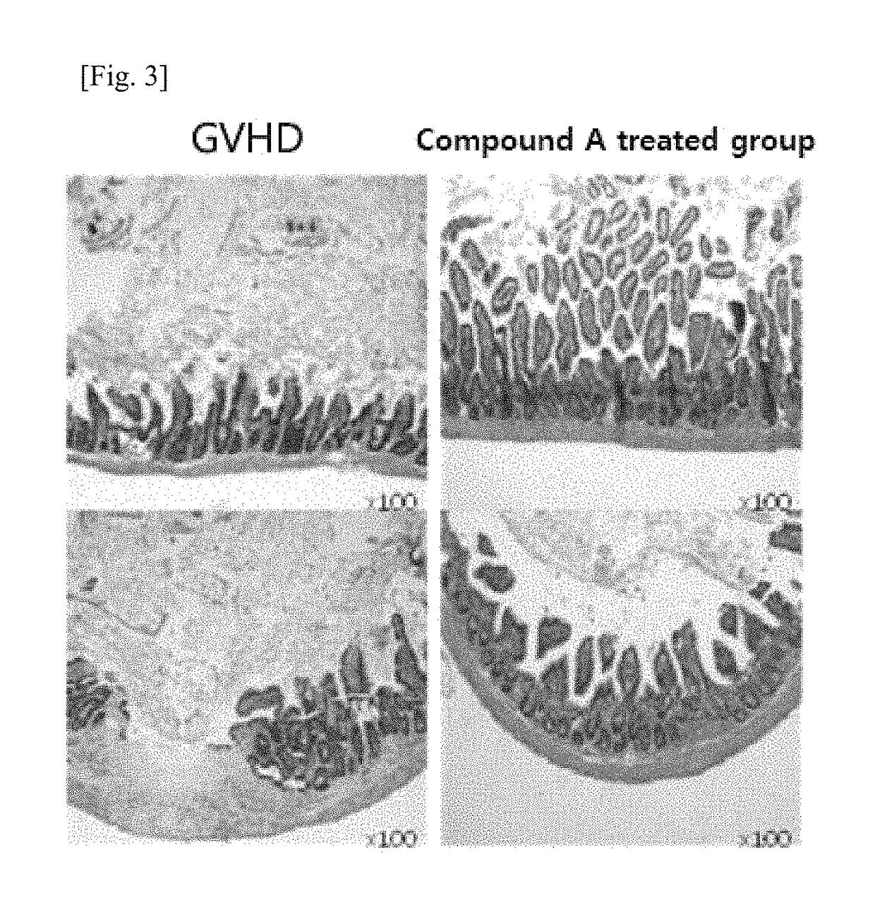 Pharmaceutical composition for inhibiting immune response through inducing differentiation into regulator T cells and promoting proliferation of regulator T cells