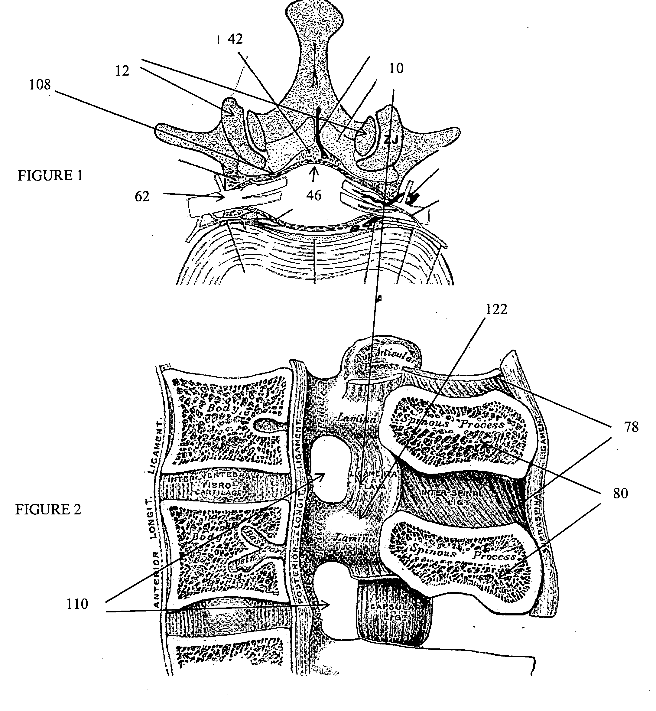 Devices and methods for tissue access