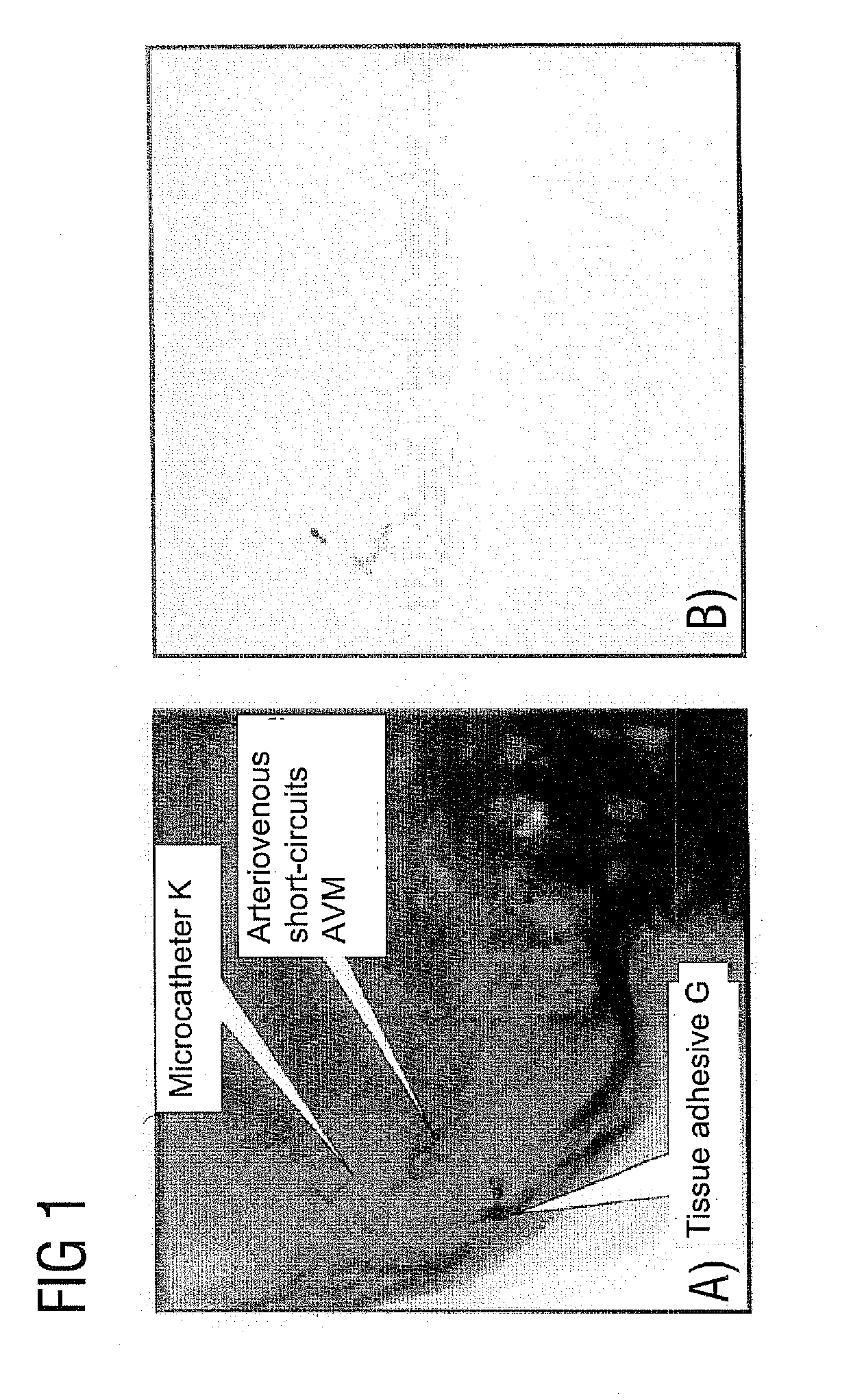 Method for computing a color-coded analysis image