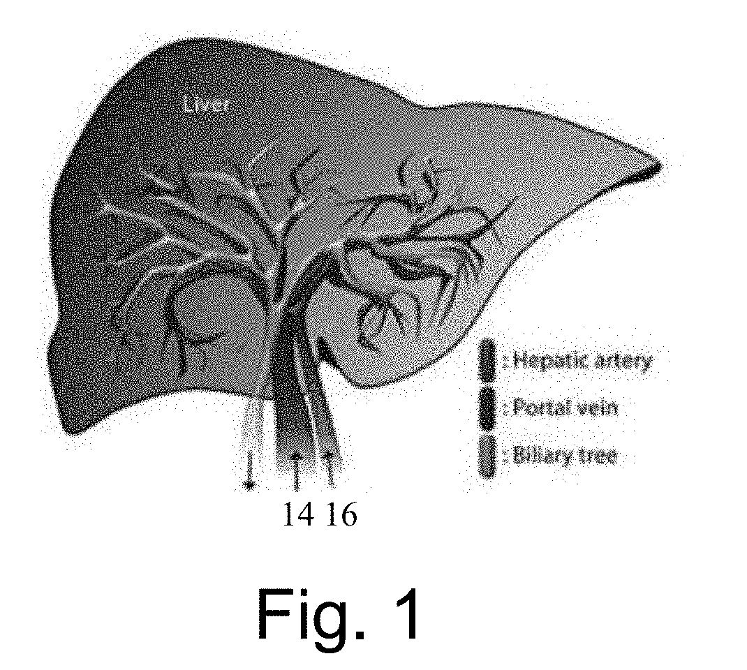 Time-based parametric contrast enhanced ultrasound imaging system and method