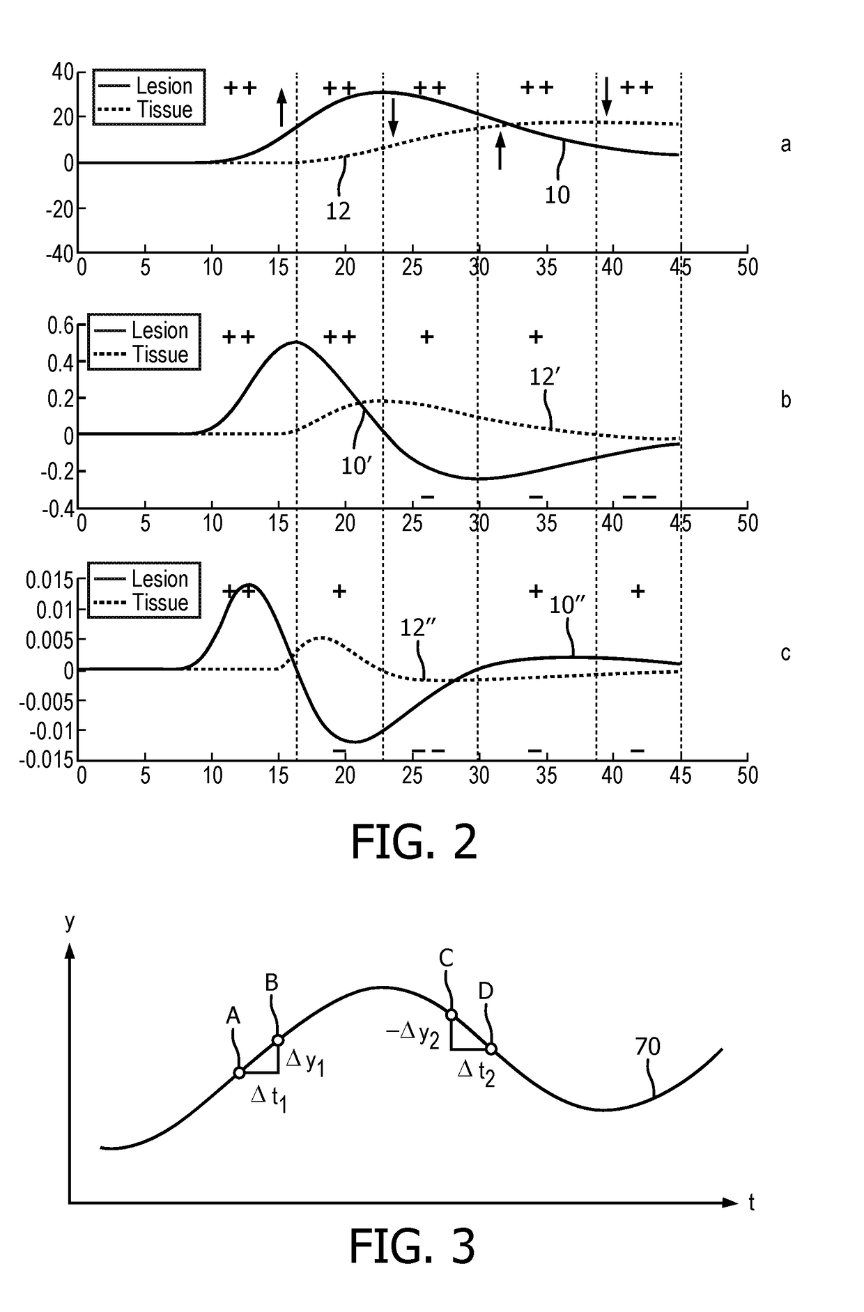 Time-based parametric contrast enhanced ultrasound imaging system and method