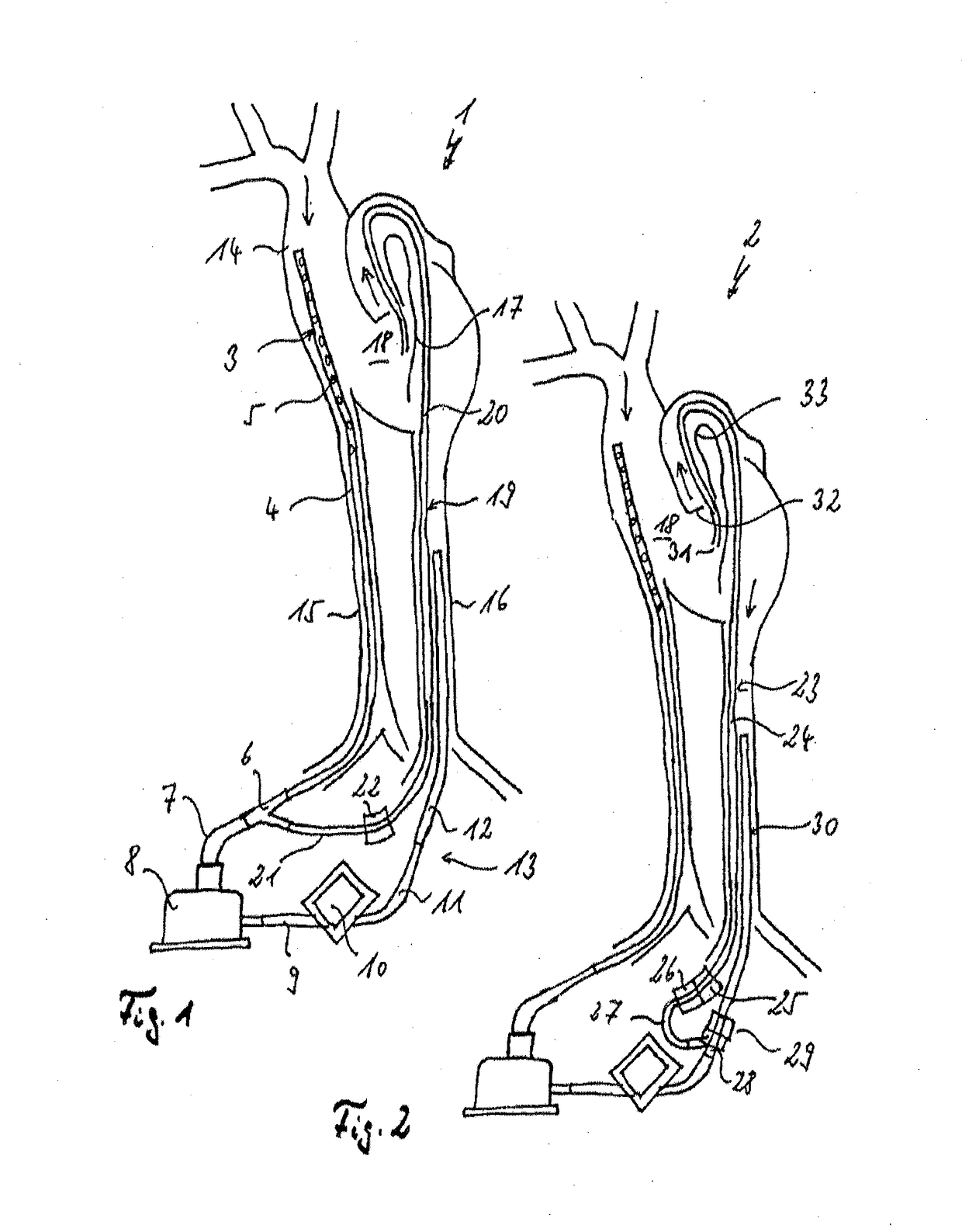 Assembly comprising a suction line, a pressure line and a pump