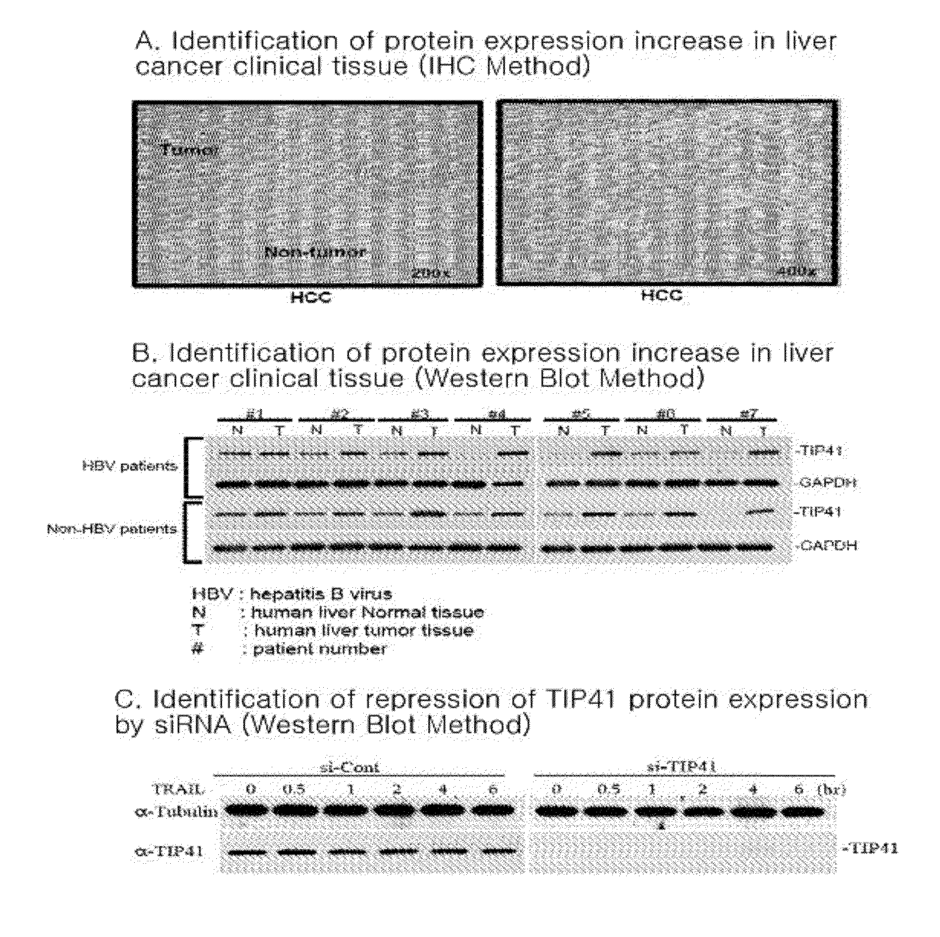 Composition for enhancing TRAIL sensitivity comprising inhibitors for expression or activity of TIP41 as a target gene of TRAIL sensitizer