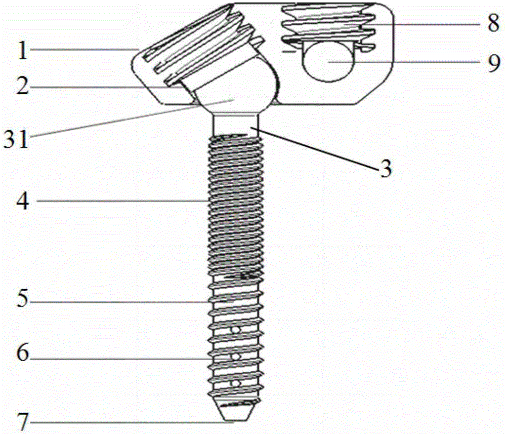Low-profile bidirectional locking large-angle universal pedicle screw