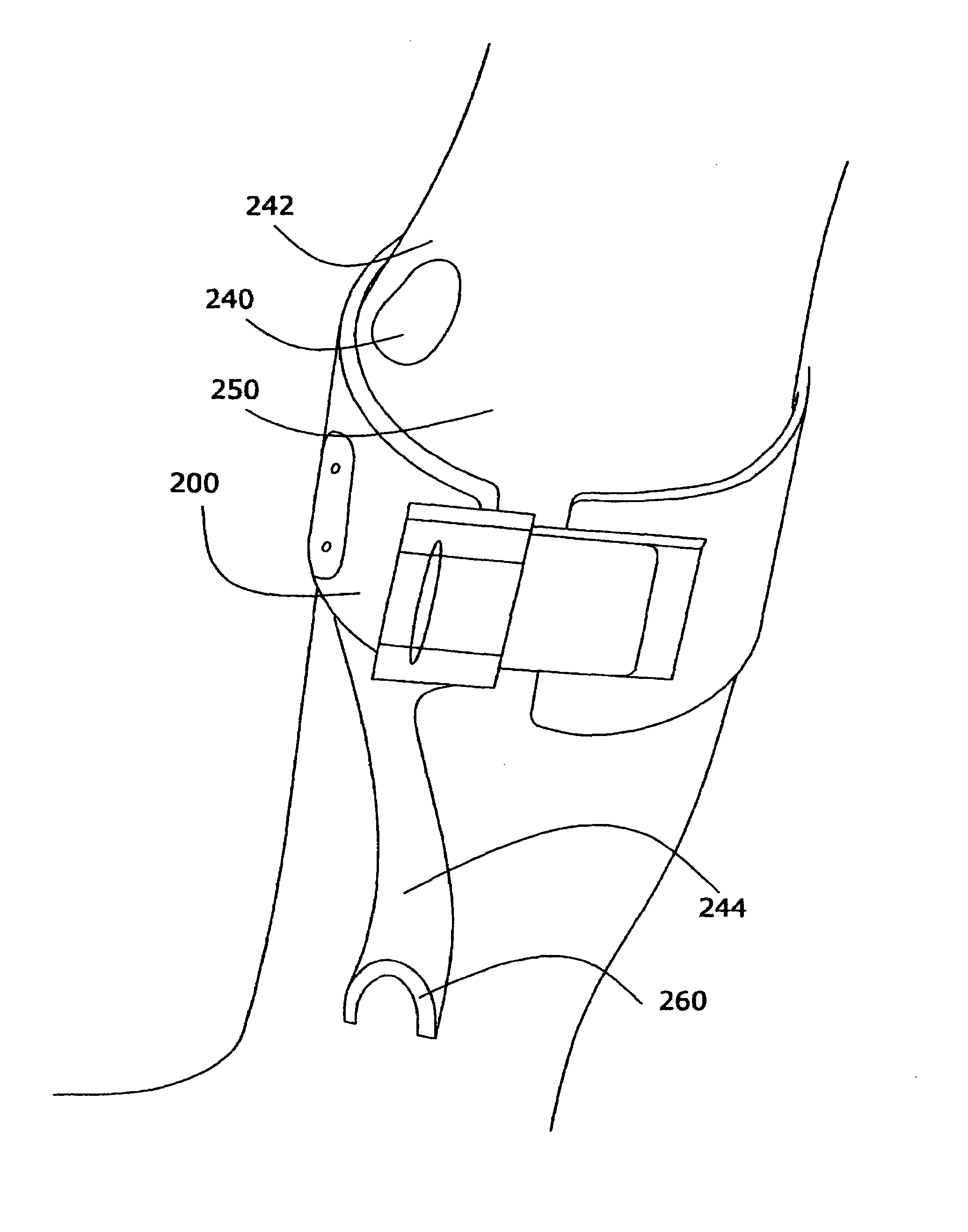 Surface neuroprosthetic device having a locating system
