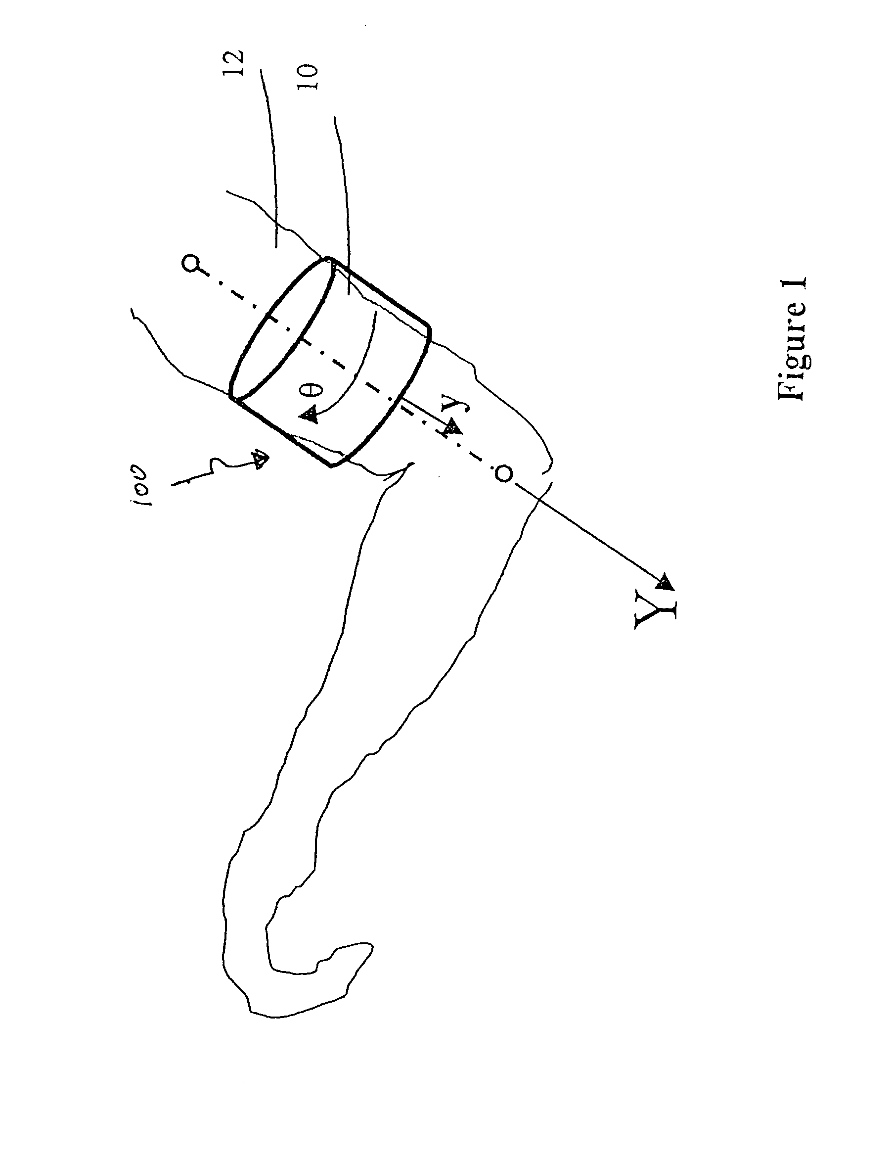 Surface neuroprosthetic device having a locating system