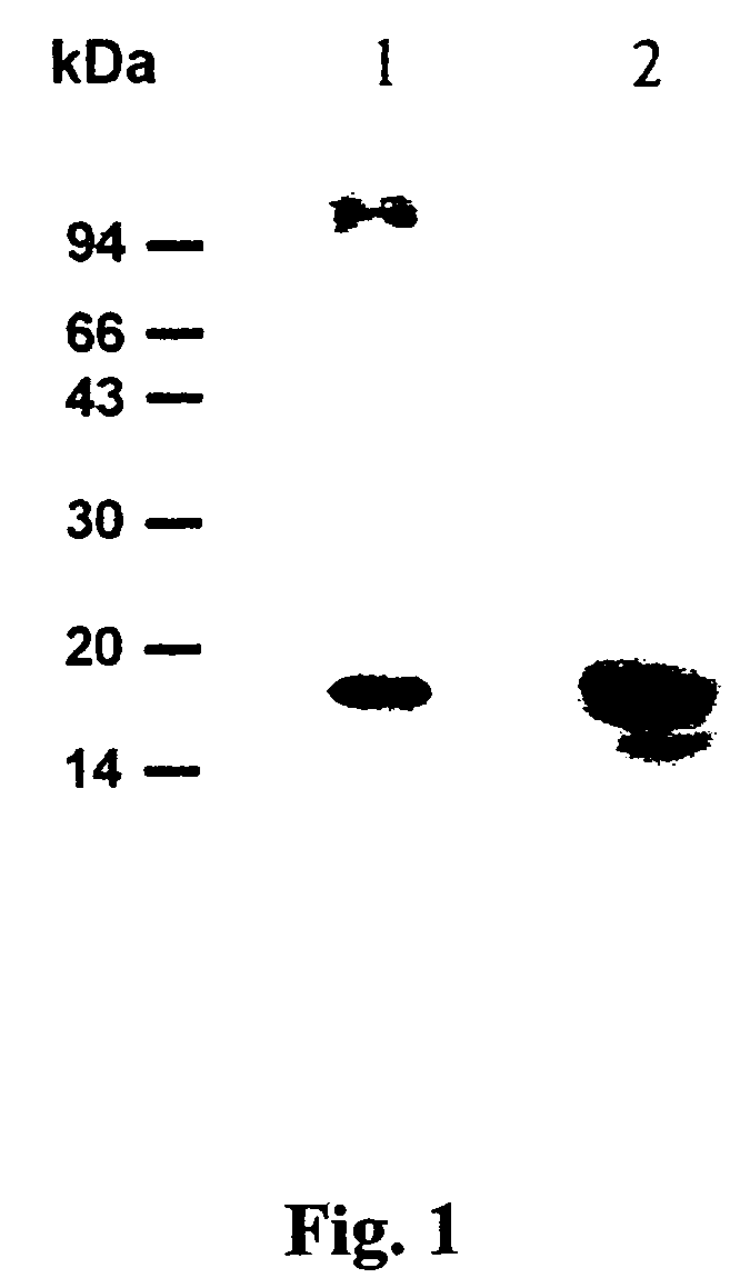 Transgenic plants and plant cells with reduced expression of invertase inhibitors