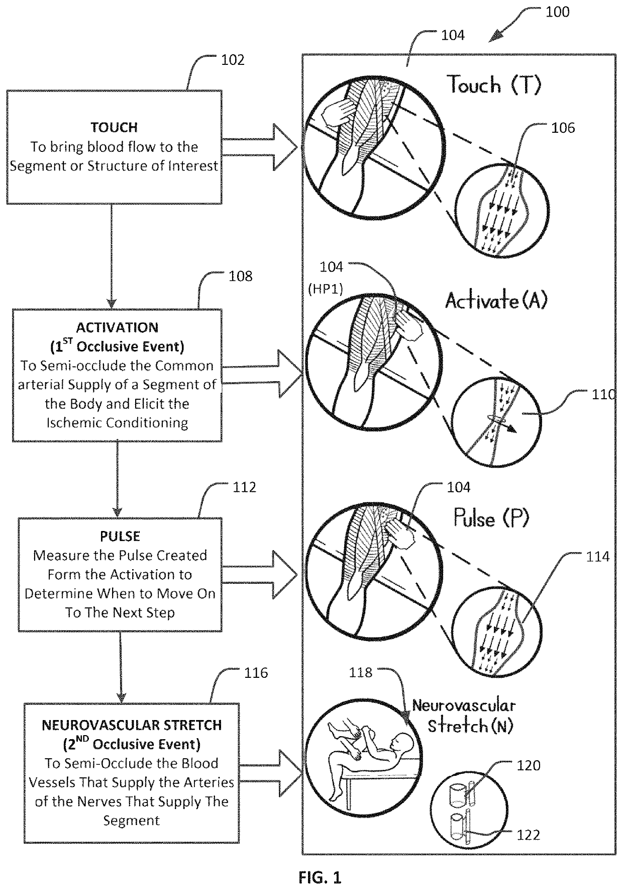 Expert associations-based treatment system for reducing tissue damage from reperfusion injury