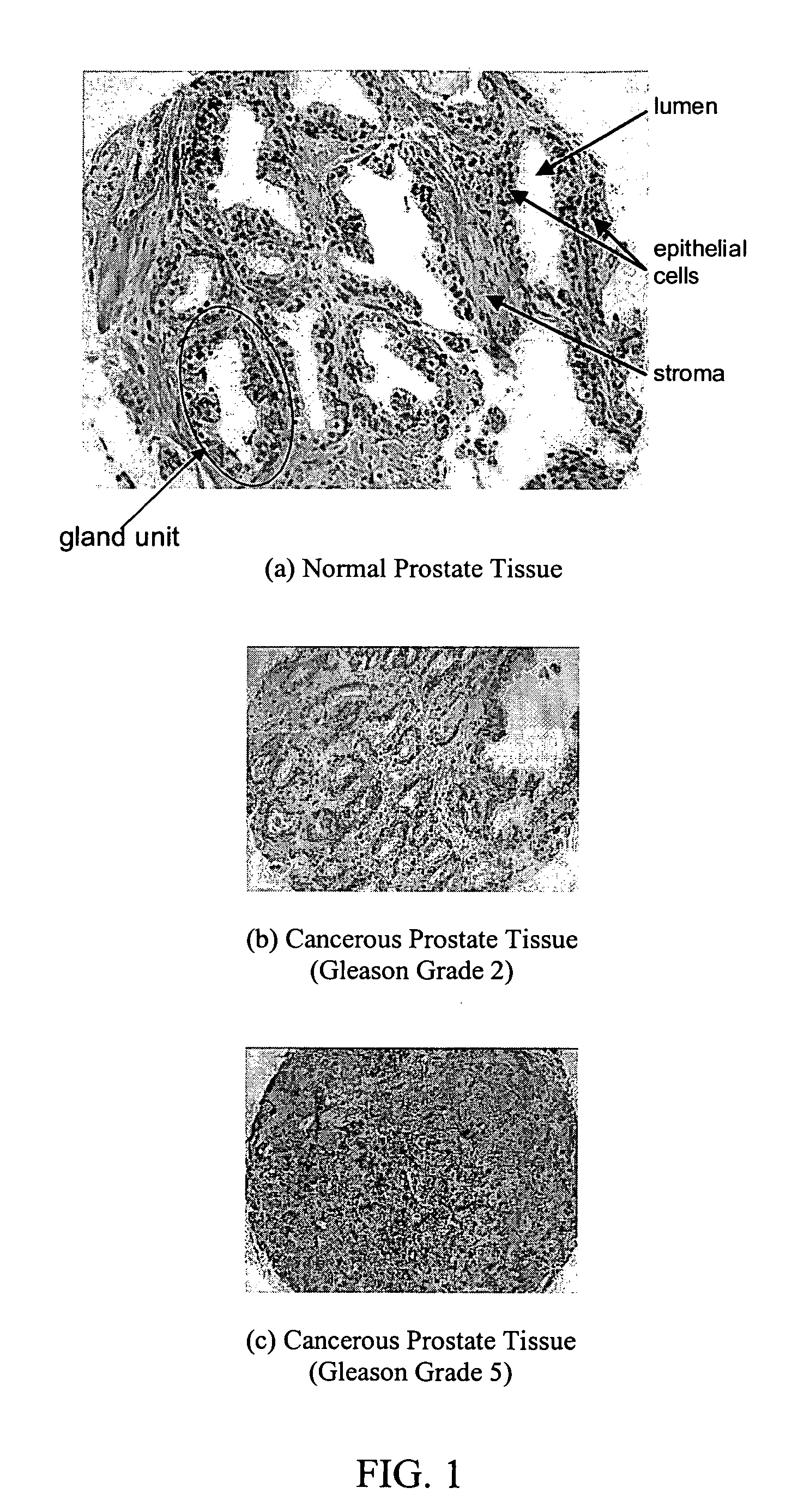 Systems and methods for automated diagnosis and grading of tissue images