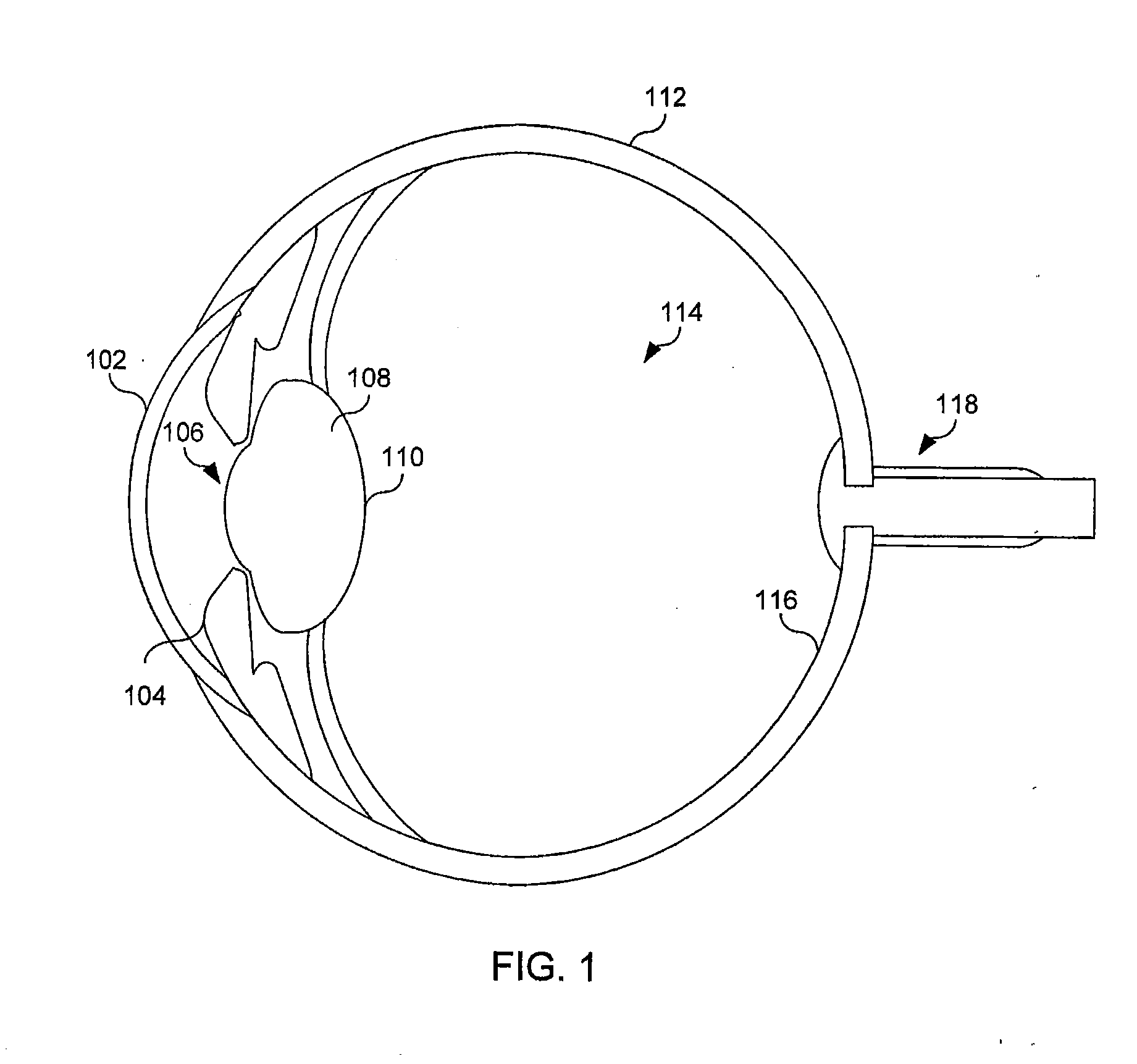 Reduced profile intraocular lens