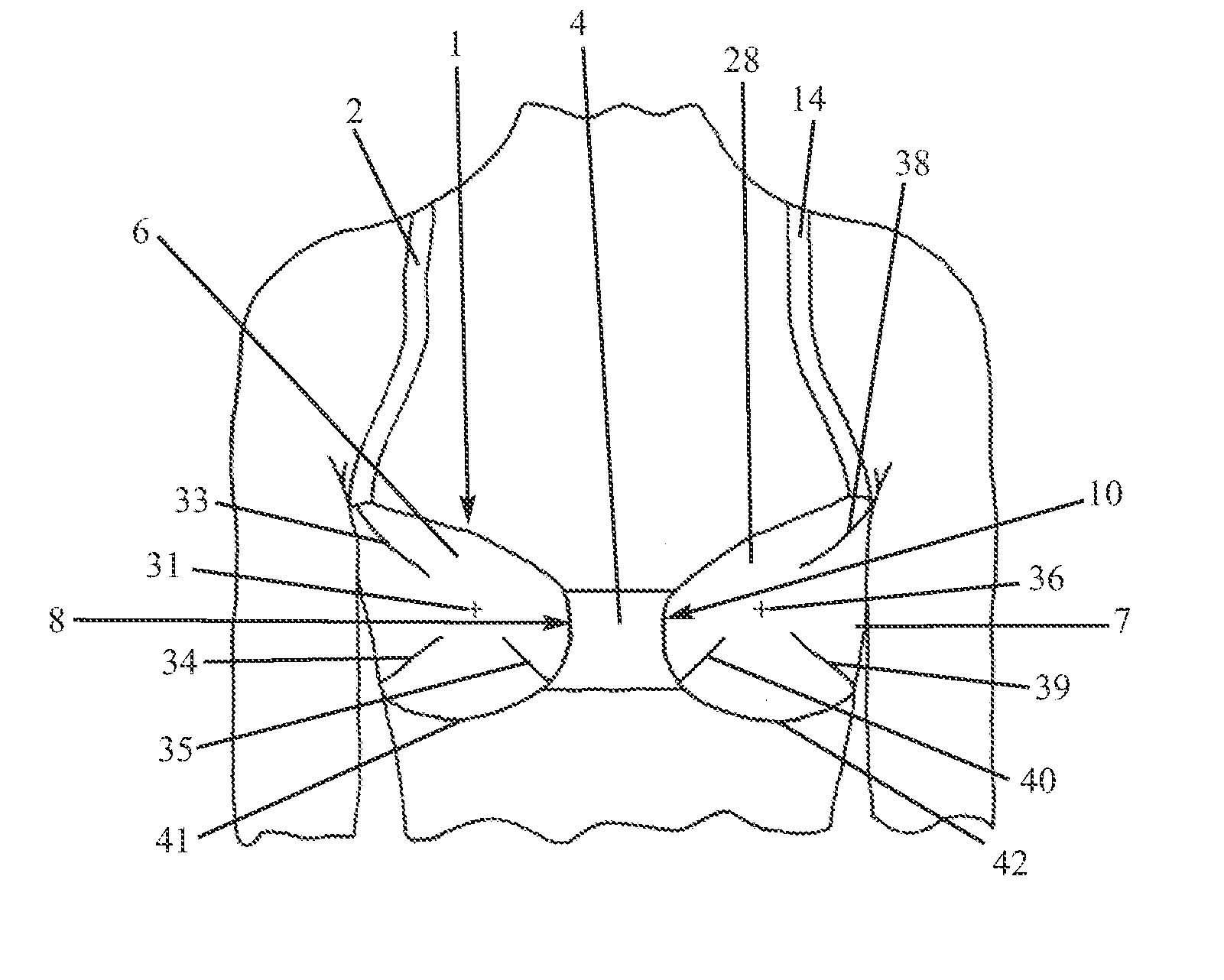 Breast supporting garment