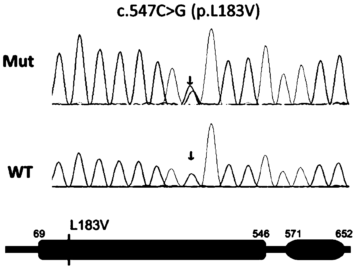 HPR1 gene mutant and application thereof for preparing diagnostic reagent for deafness