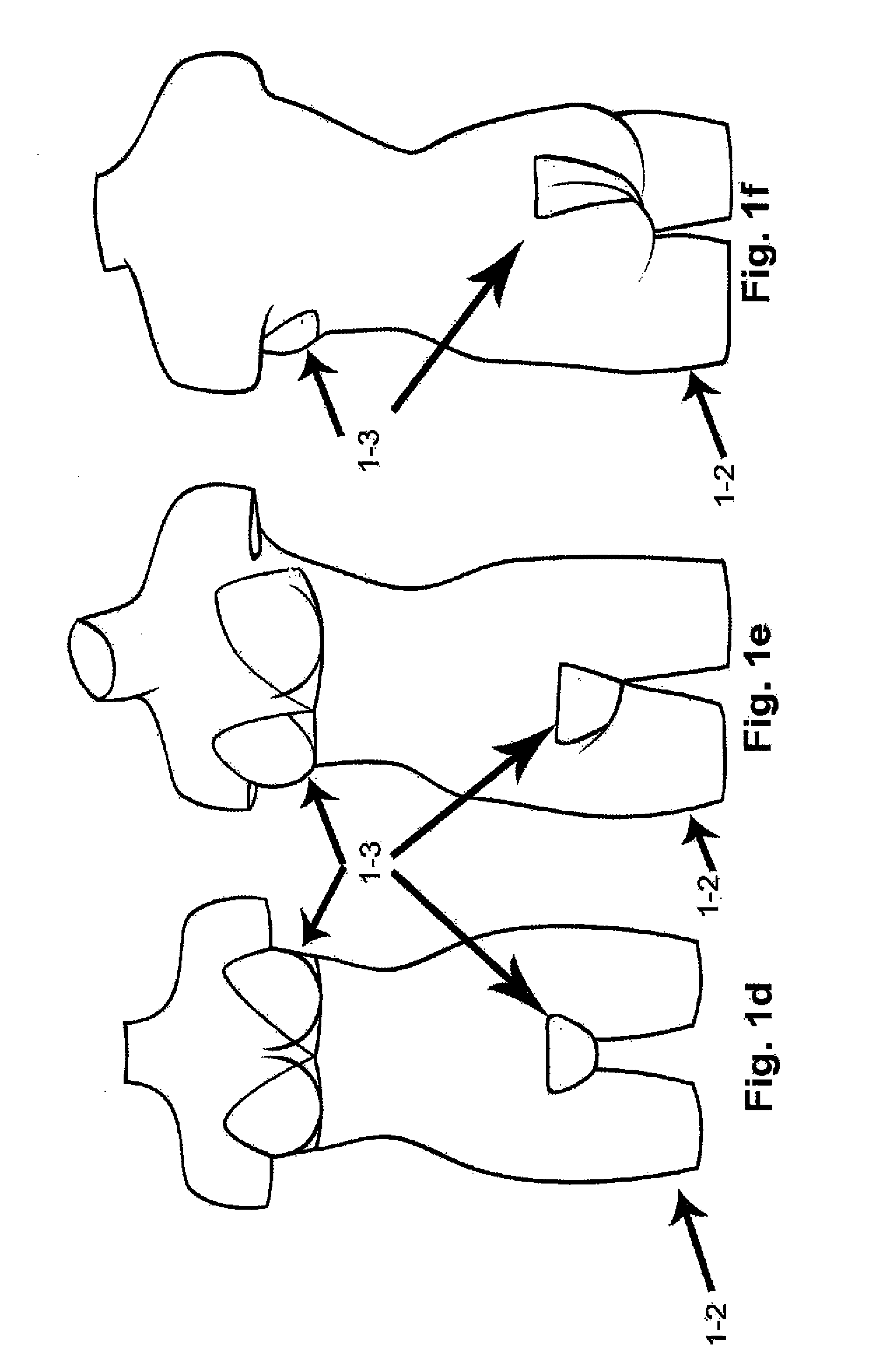 System for releasably attaching an article of clothing to a body