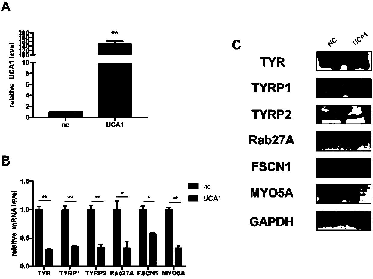 Application of UCA1 as target site to preparation of drugs for treating hyperpigmentation dermatoses