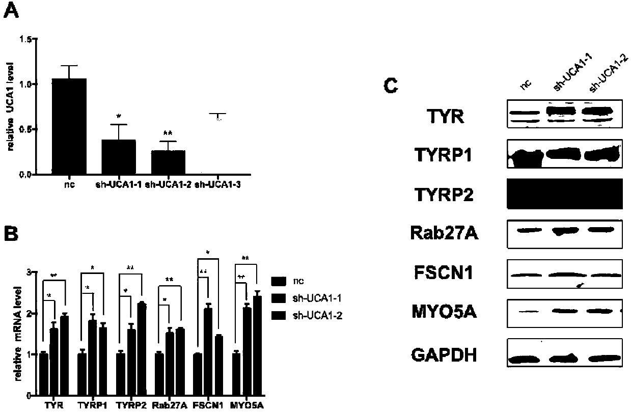 Application of UCA1 as target site to preparation of drugs for treating hyperpigmentation dermatoses