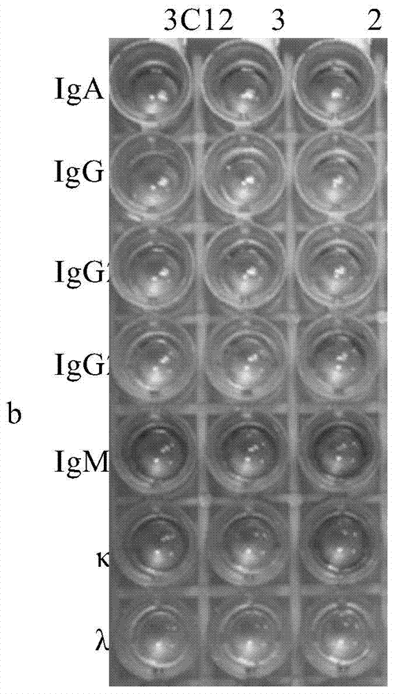 Chicken interleukin-10 monoclonal antibodies and preparation method and application thereof