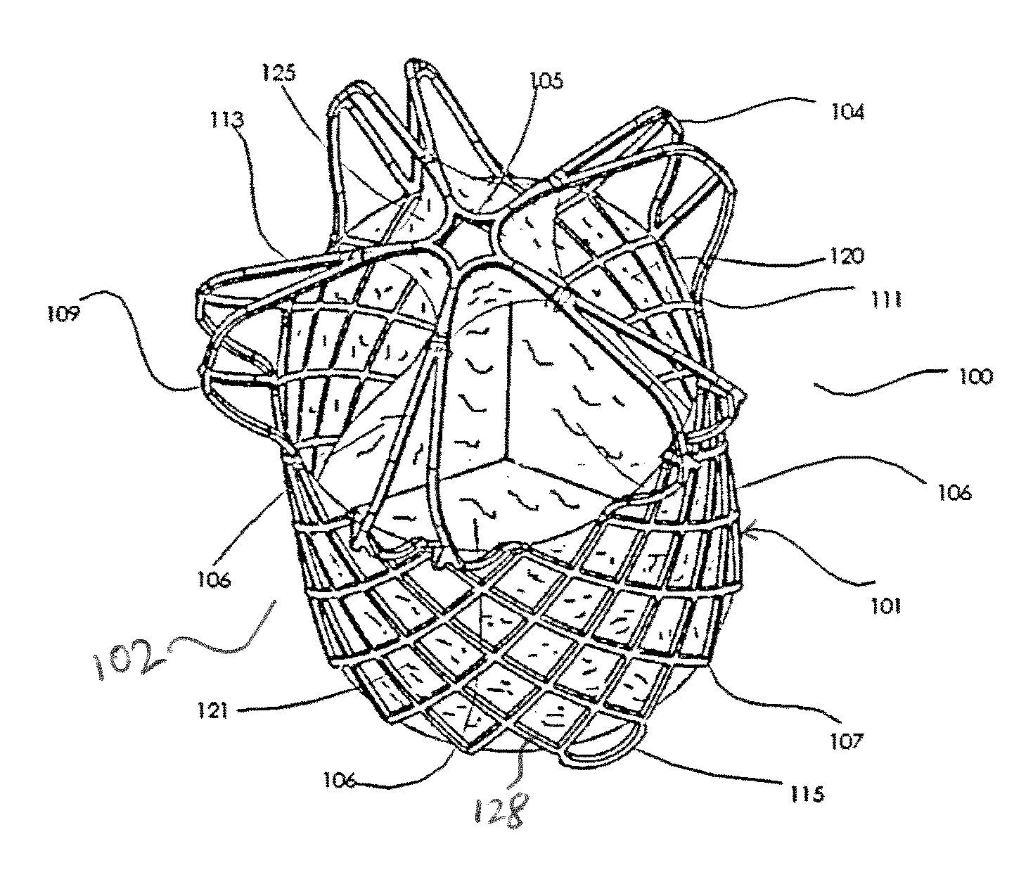 Transcatheter Pulmonary Ball Valve Assembly