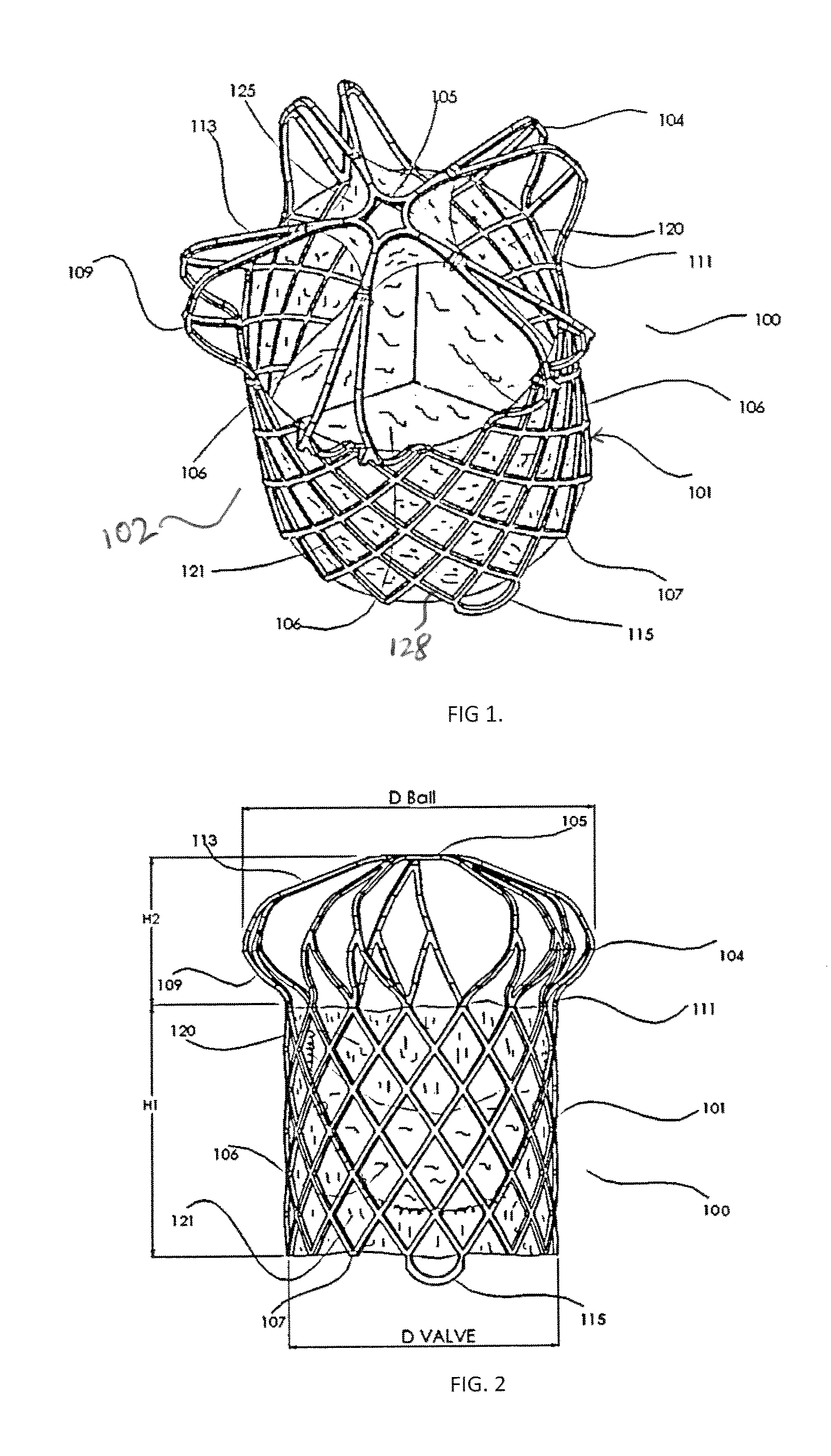 Transcatheter Pulmonary Ball Valve Assembly