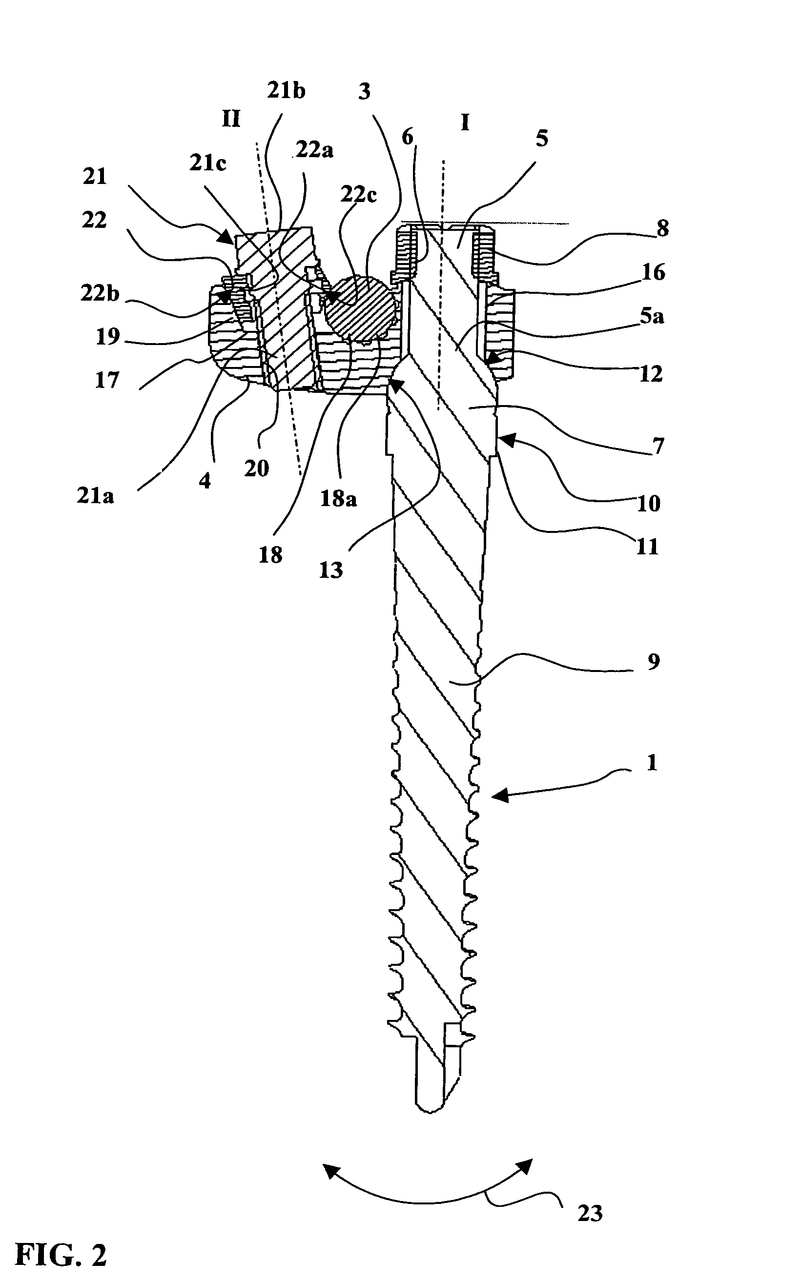 Vertebral column support device which is assembled by means of clamping