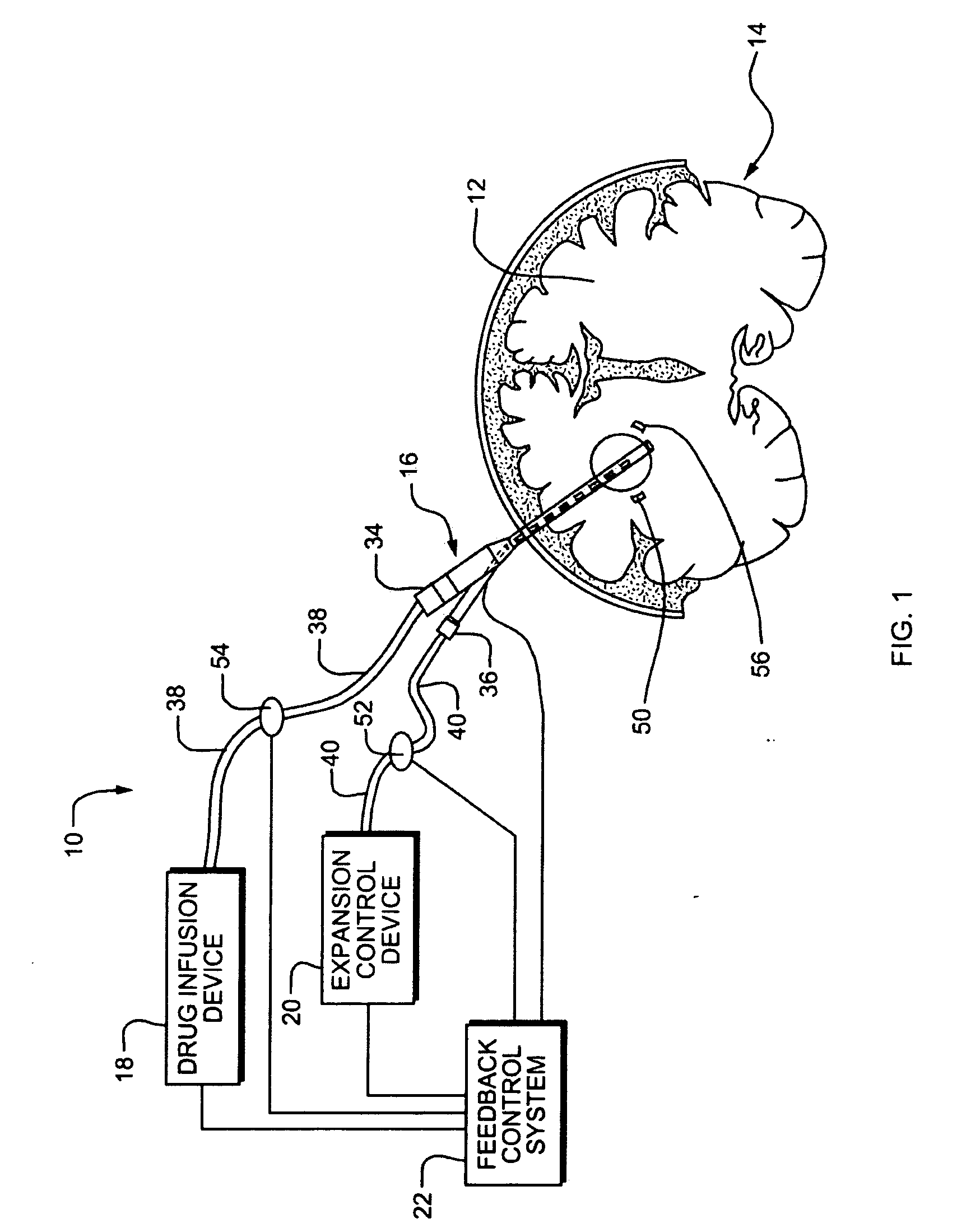Systems and Methods for Drug Infusion with Feedback Control